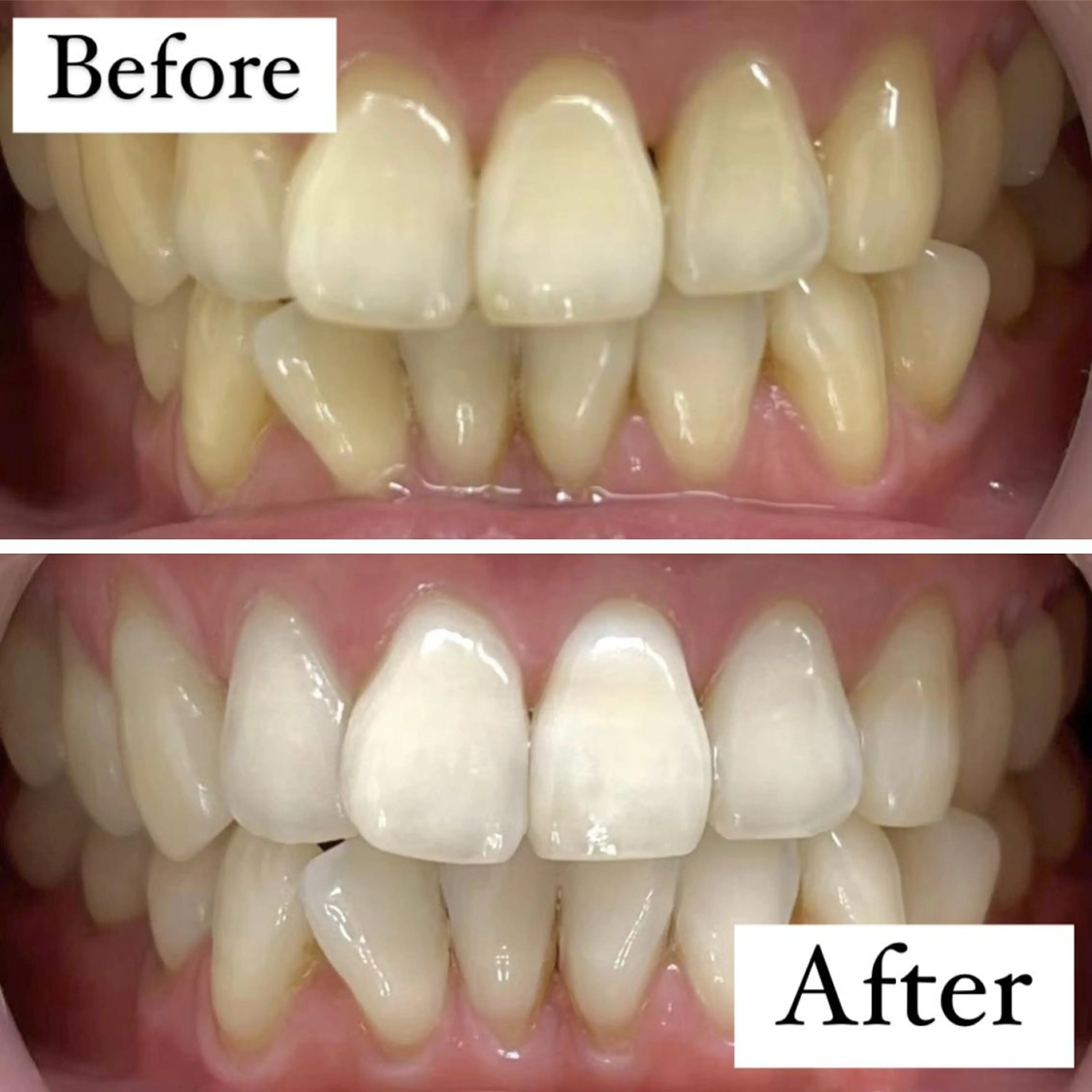 LBSホワイトニング 🌐渋谷店 小河原のエステ・リラクイメージ