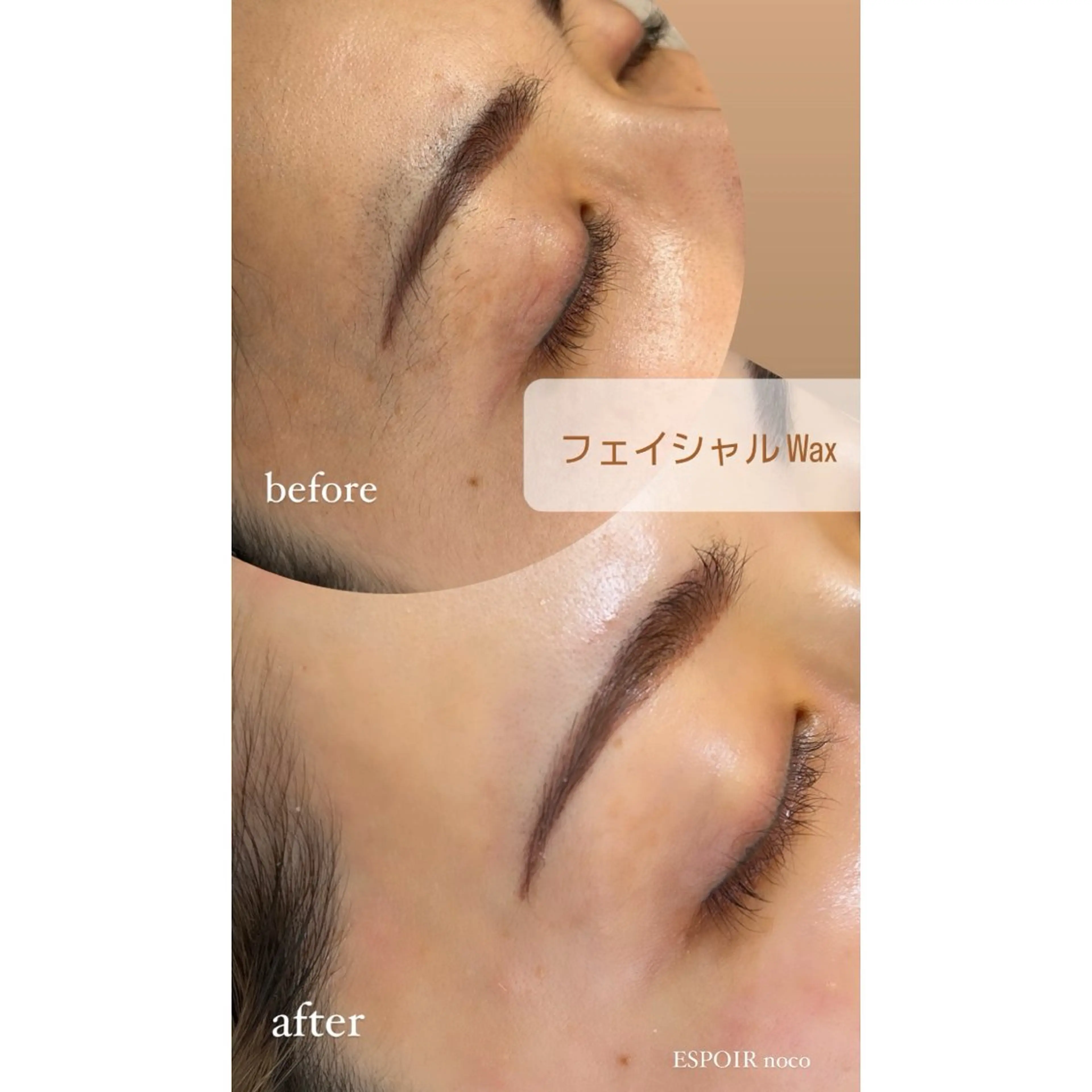 ワックス脱毛🌈 ESPOIRnocoのエステ・リラクイメージ