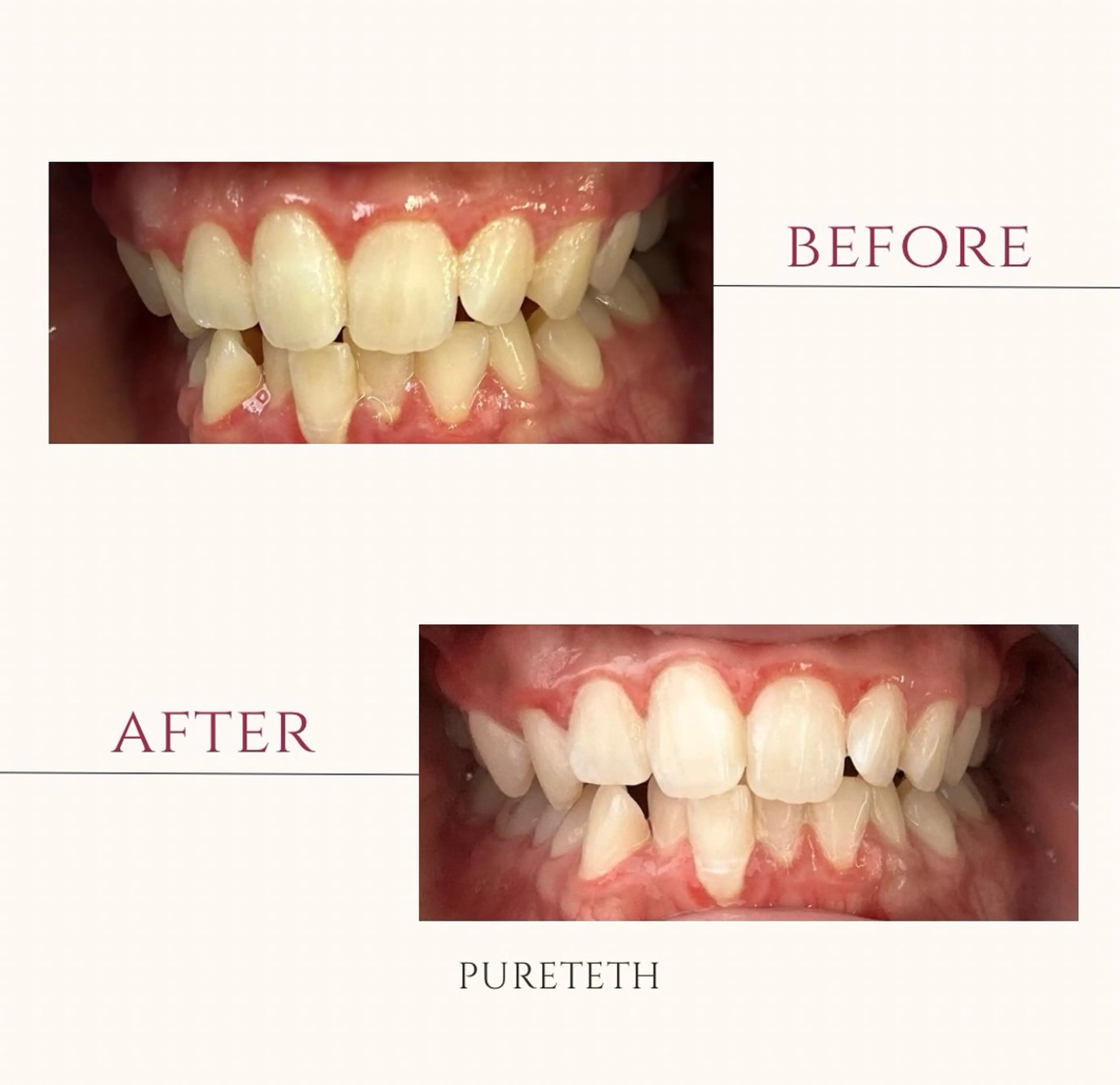 エステ ホワイトニングサロンPURETETH所属・ホワイトニングサロン PURETETHのエステ・リラクイメージ