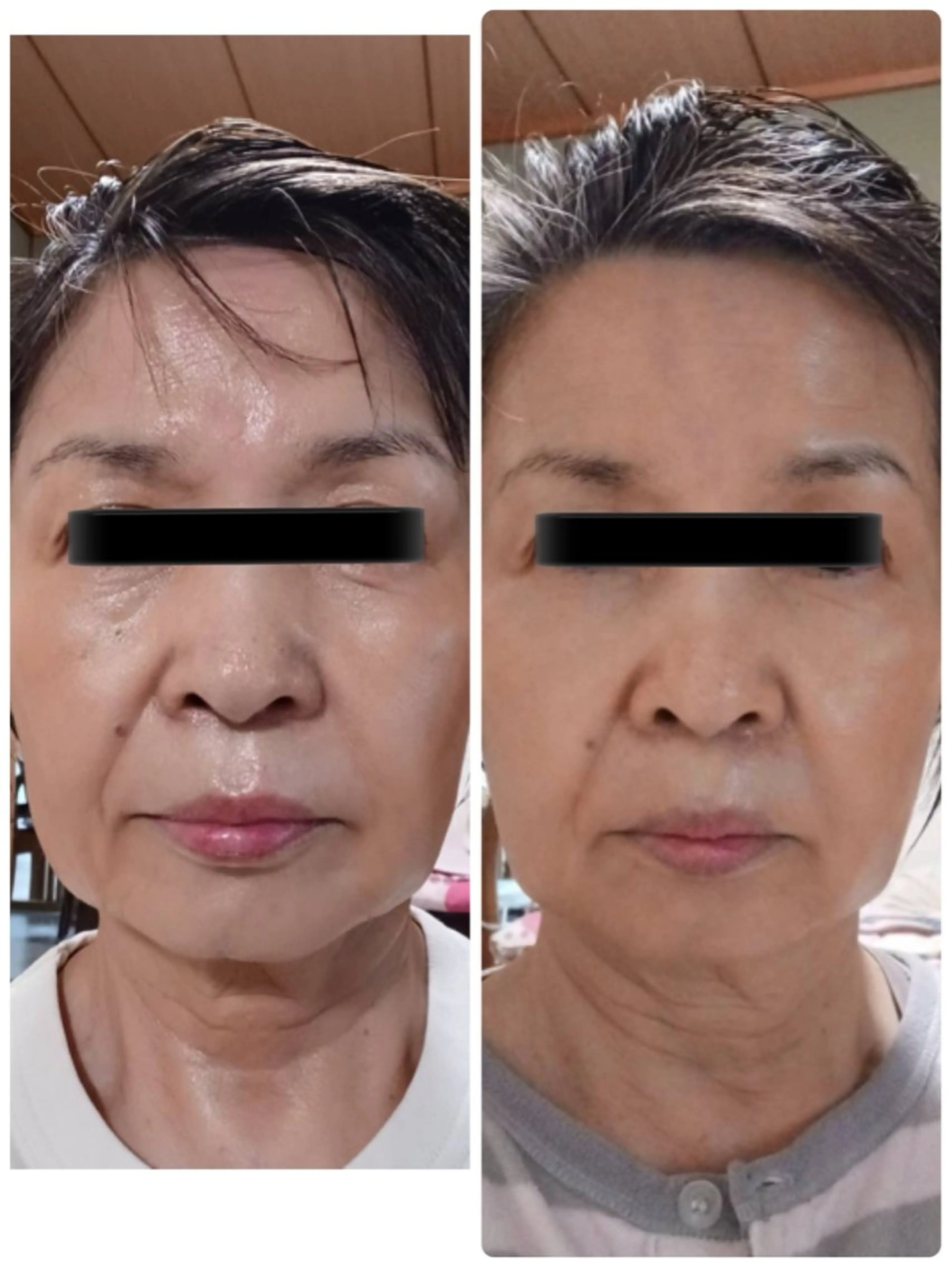 Naris De I’m 長崎所属・立石 文香のエステ・リラクイメージ