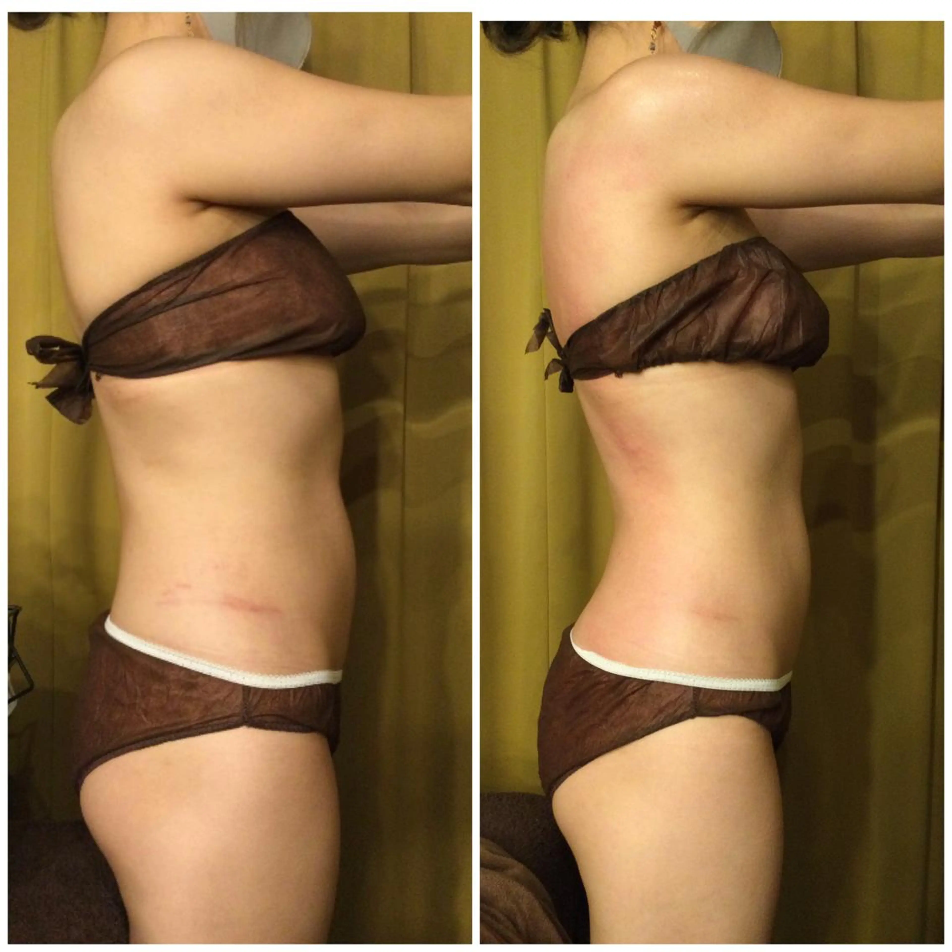 その他 小顔やたるみに特化 💚野瀬可蓮のその他イメージ