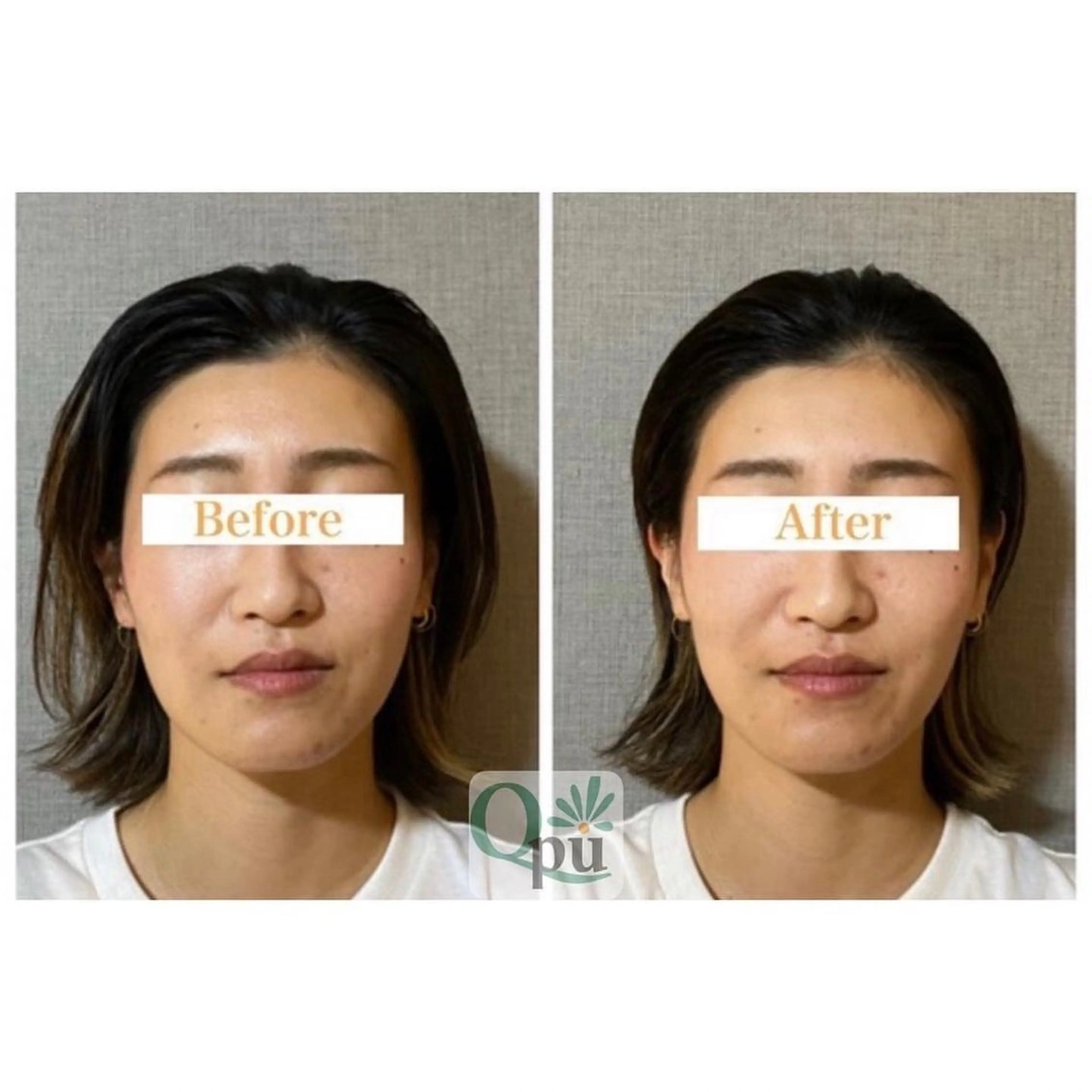 エステ リラク Qpu(キュープ)下北沢店所属・鮎川 さゆりのエステ・リラクイメージ