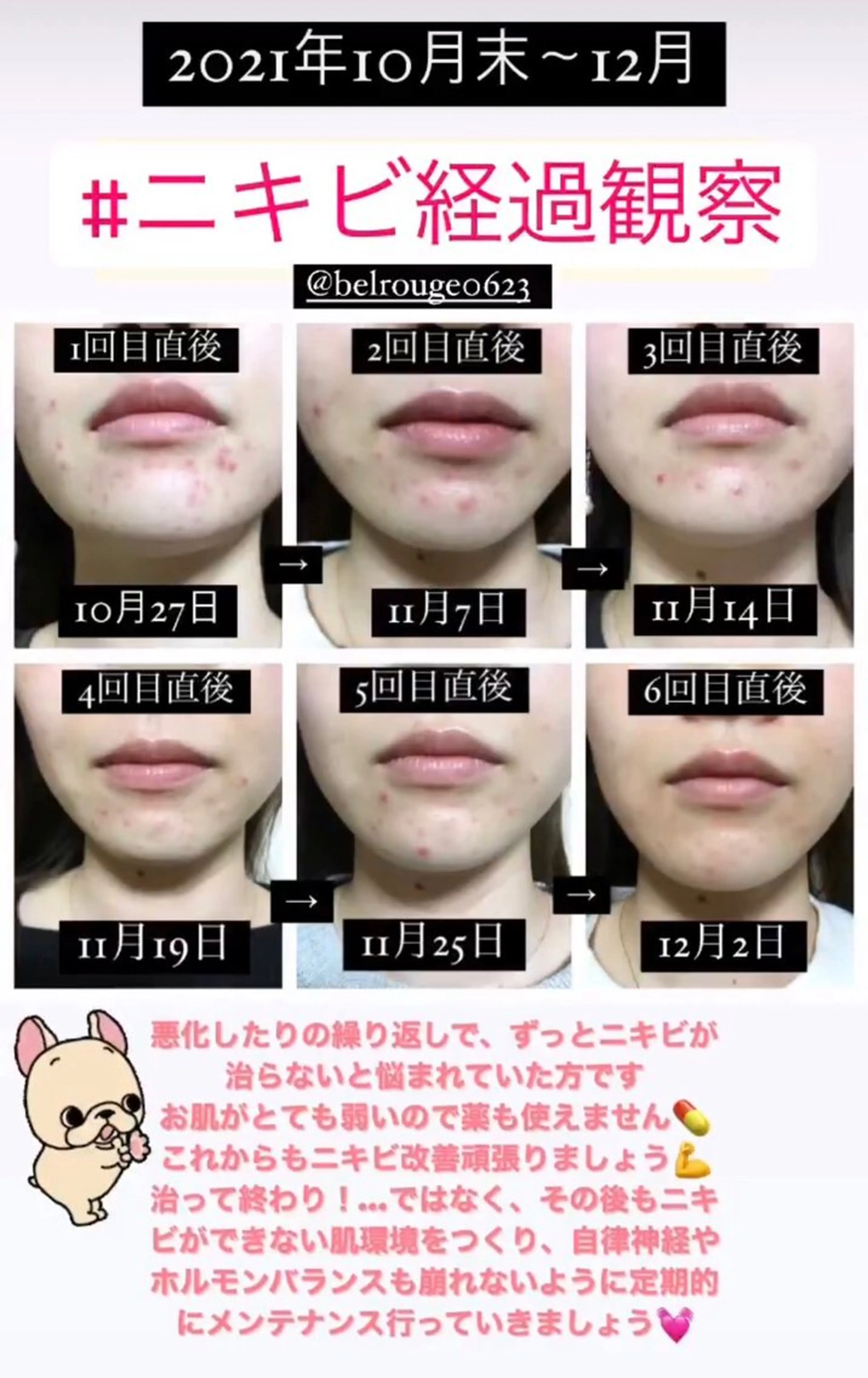 エステ 自由が丘📍 Belrougeのエステ・リラクイメージ