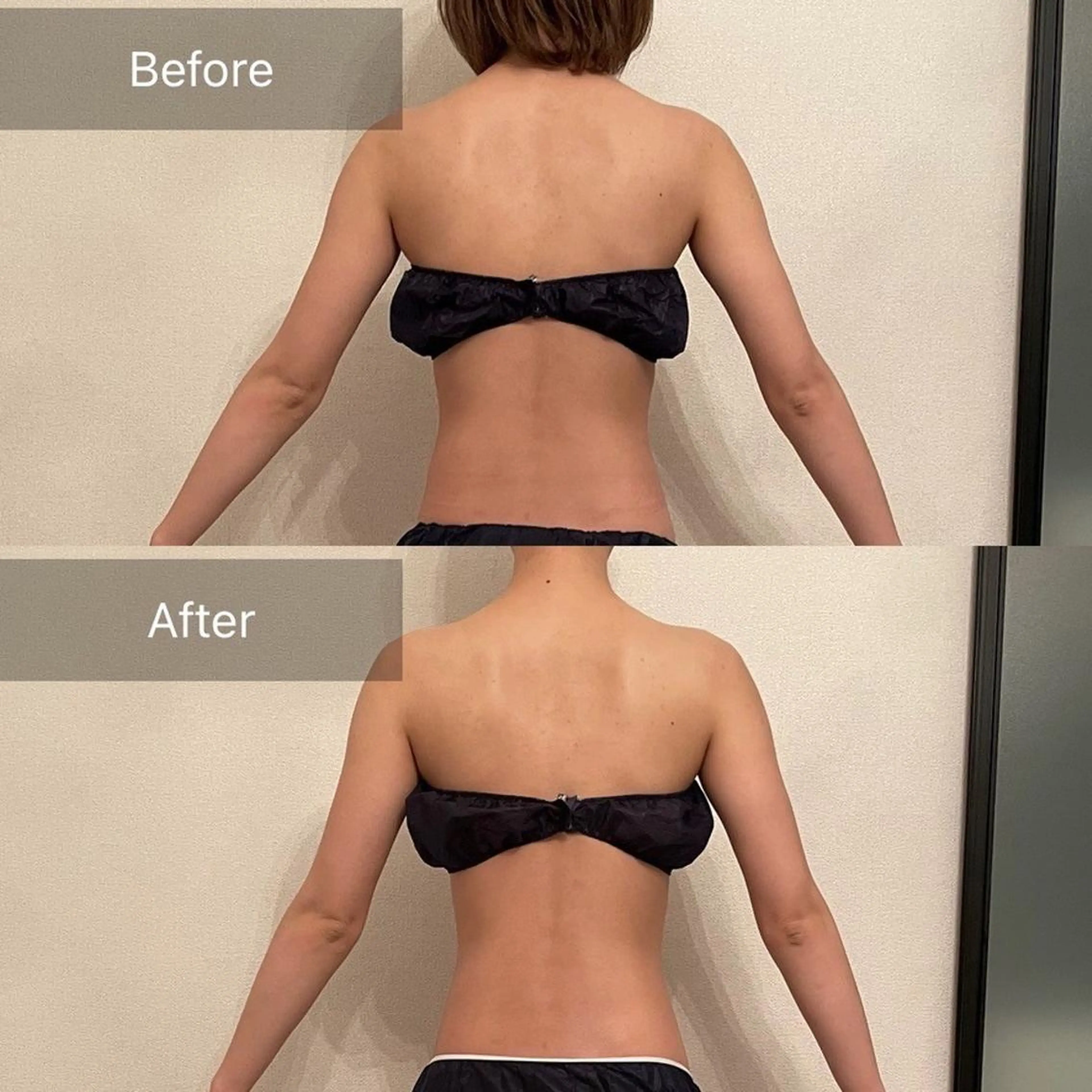 【🔥部位痩せ🔥インディバ超え45分お試し✨】選べる🌈肩凝り‼️お腹‼️太もも‼️ヒップ‼️二の腕‼️ふくらはぎ‼️の写真