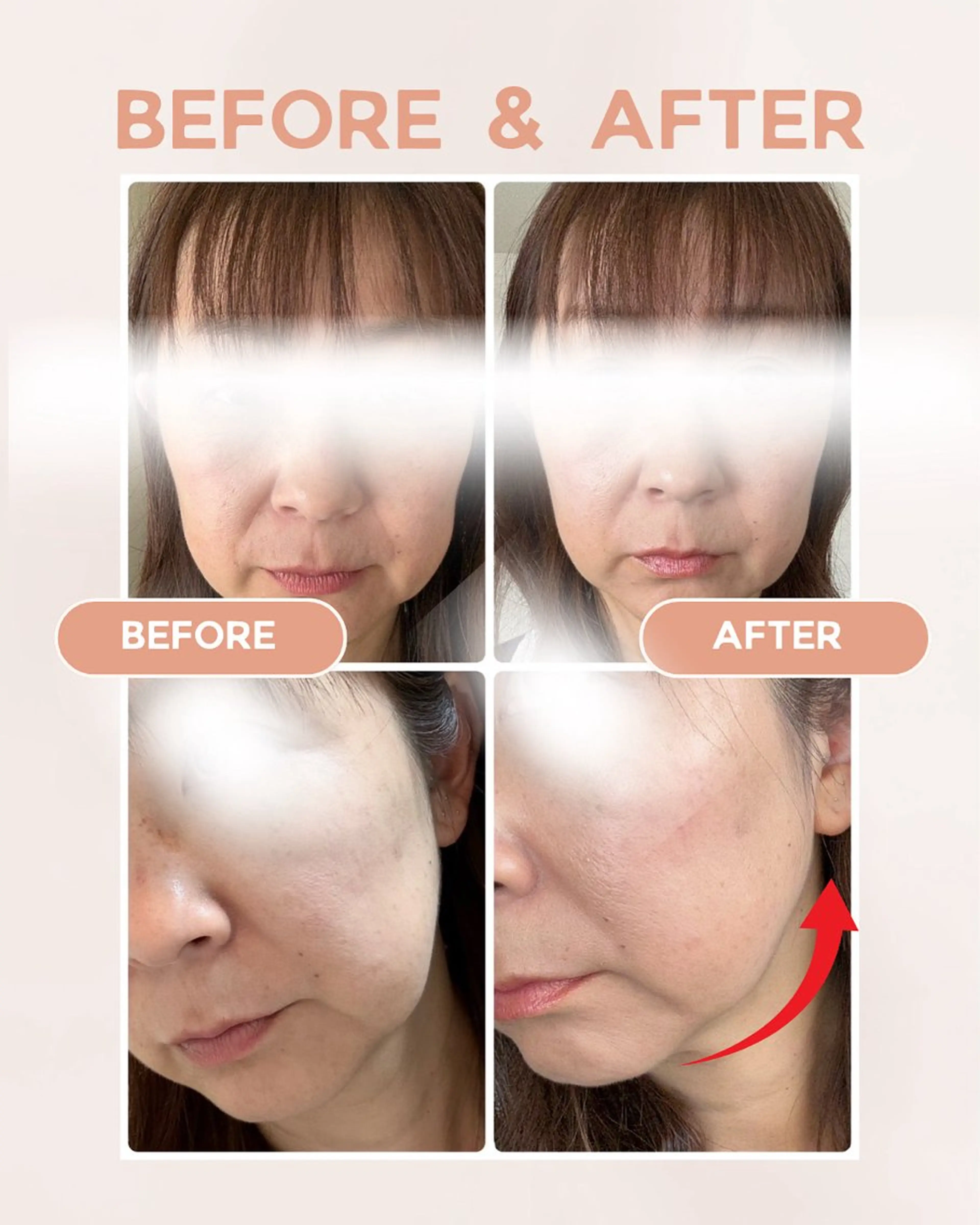 mimine エメラルド式耳つぼのその他イメージ