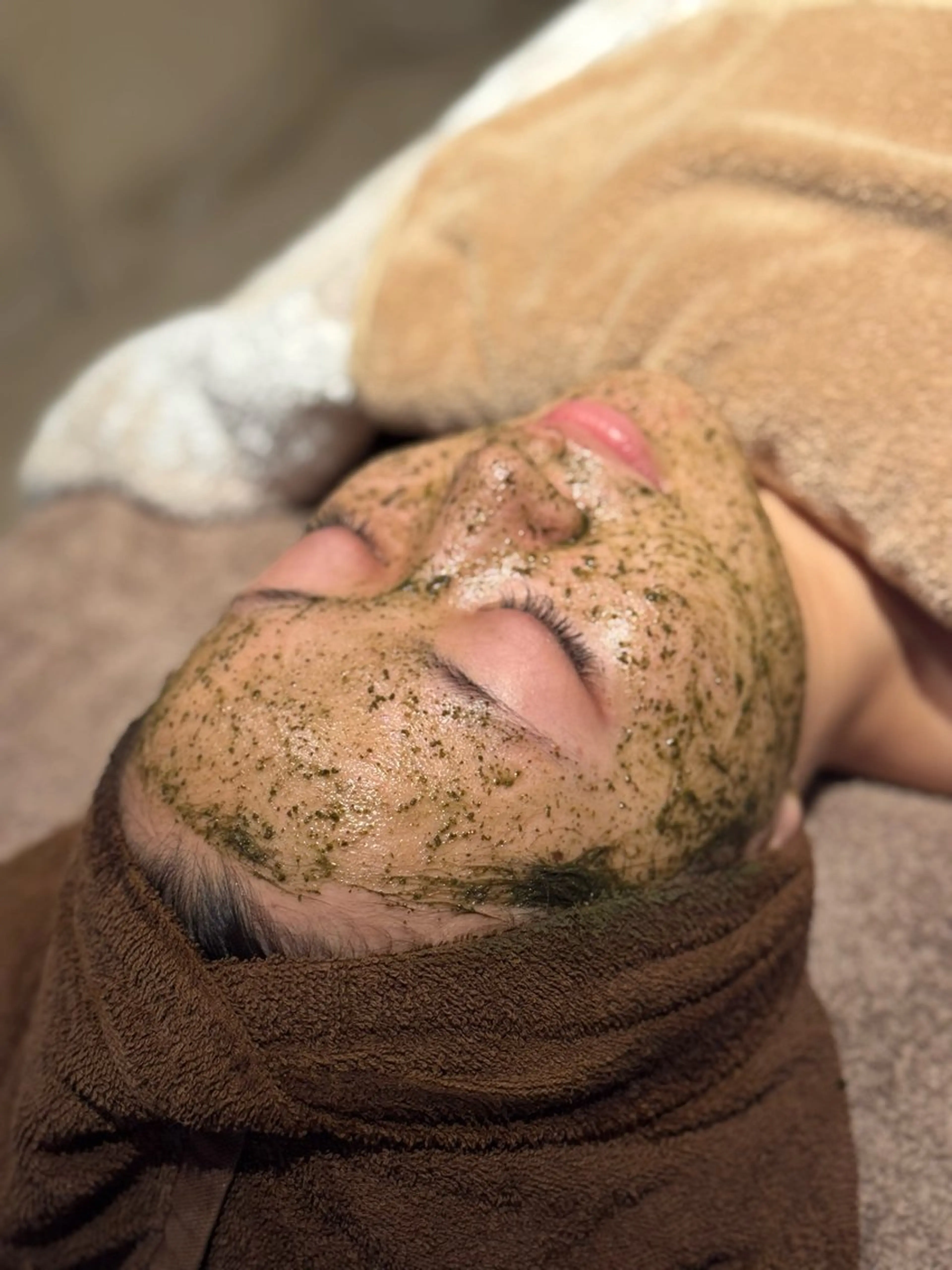 【ニキビケア】人気No.1★ハーブピーリング🌿にきび・にきび跡・毛穴に！🉐初回限定¥13000→¥6000の写真