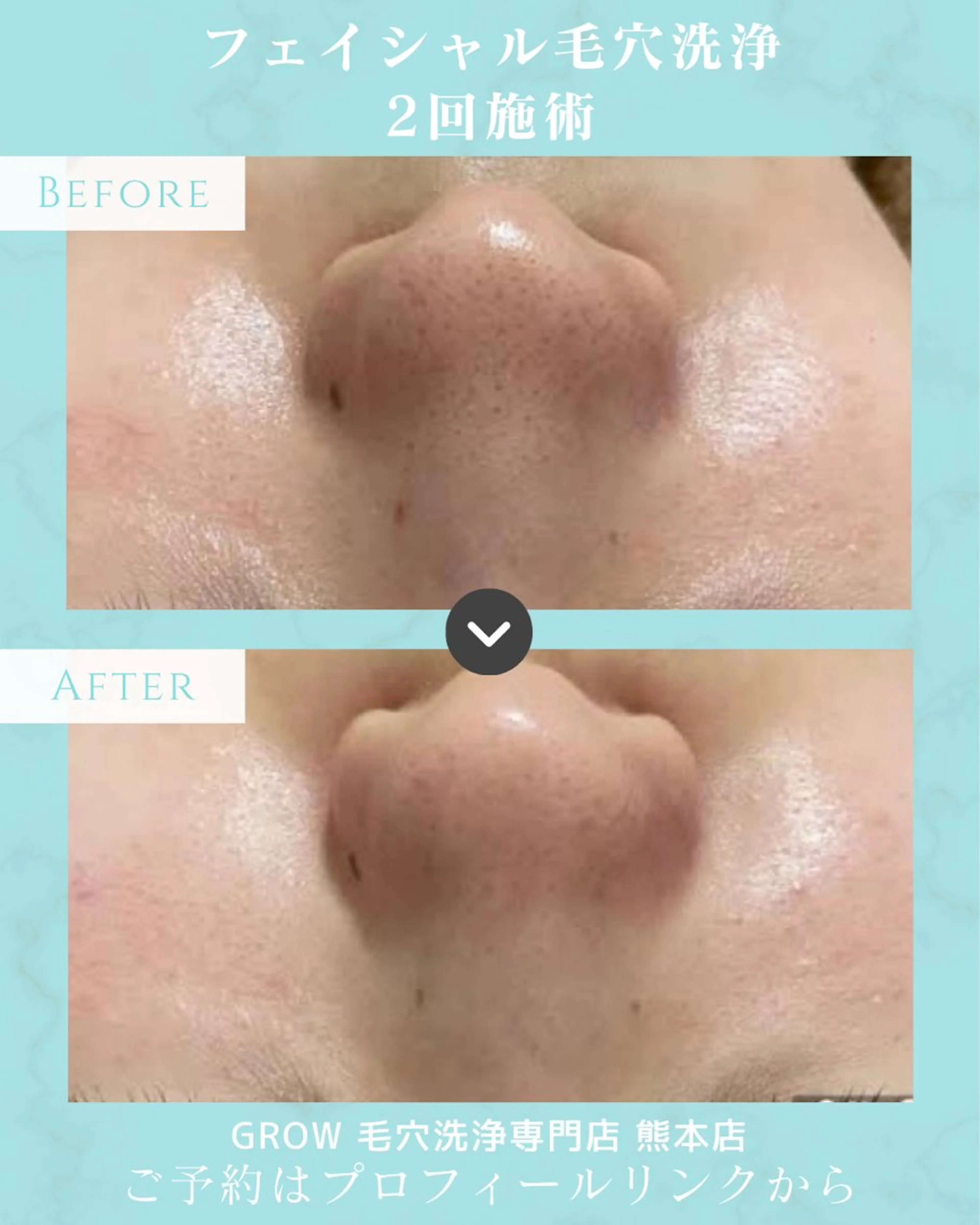 韓国式フェイシャル エステGROW熊本店のエステ・リラクイメージ