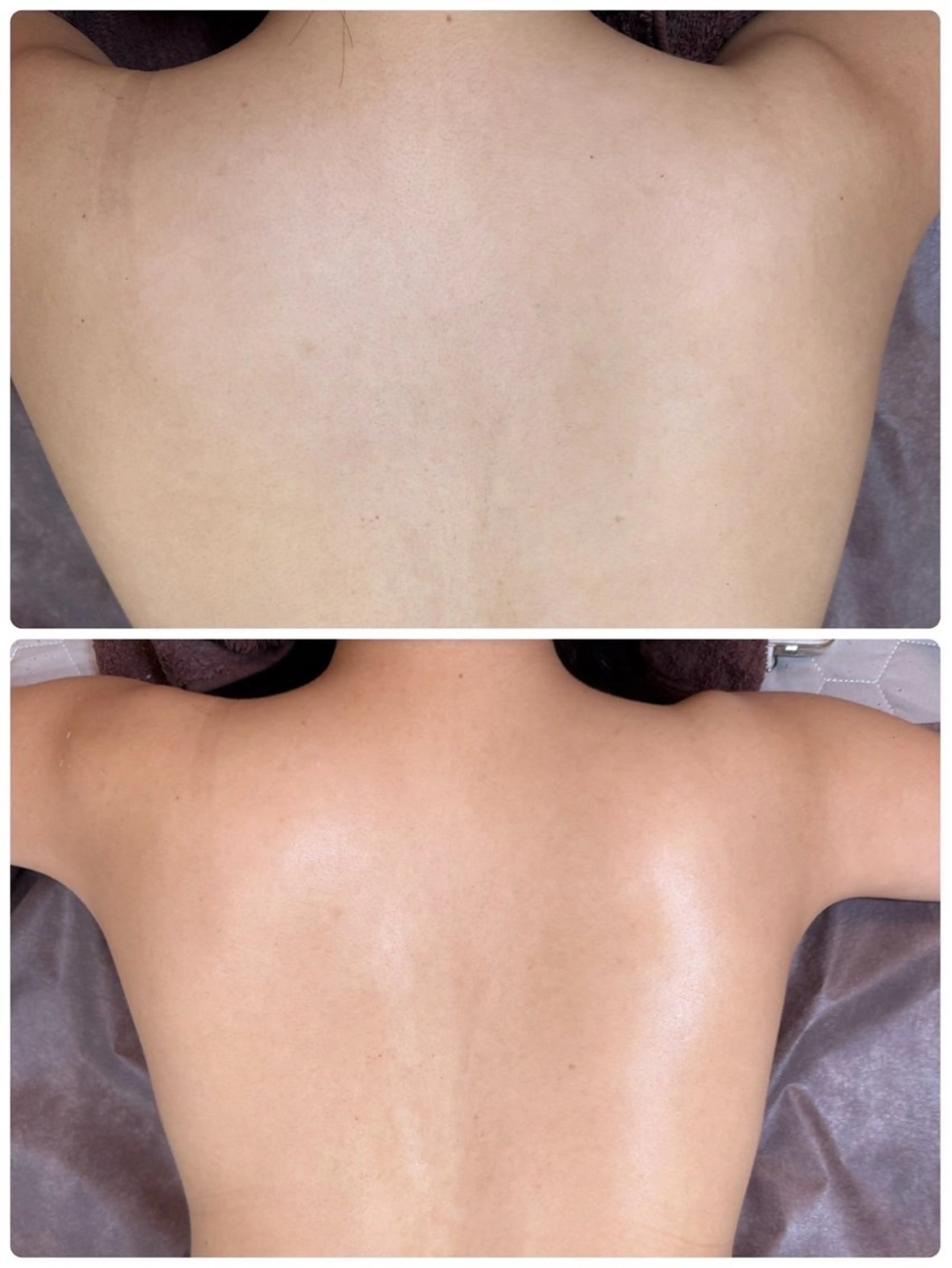 エステ Lei beauty salon所属・松ヤニワックス専門/ 梅田/Leiのエステ・リラクイメージ