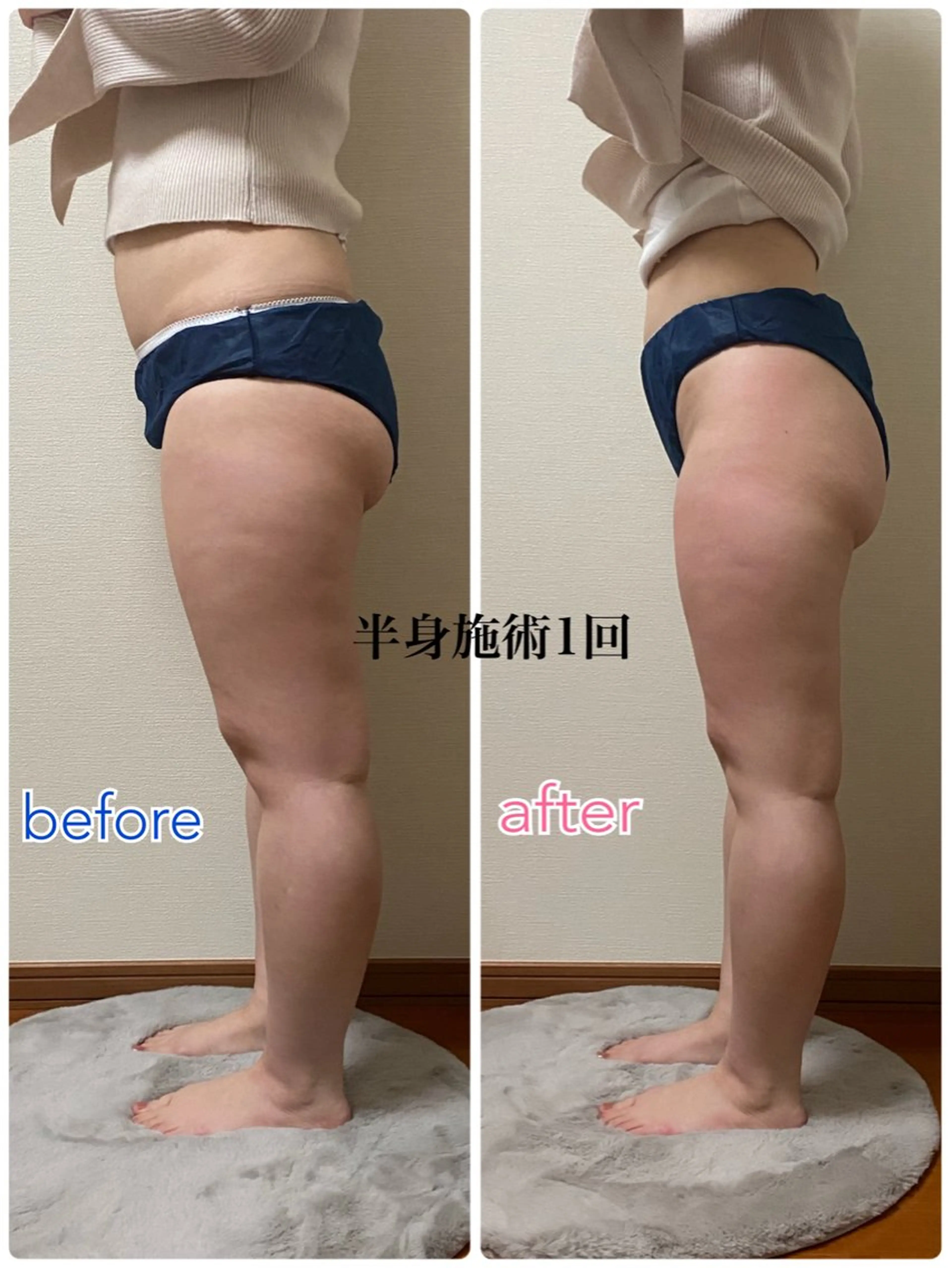 エステ ACORAL痩身 NAZUKIのエステ・リラクイメージ