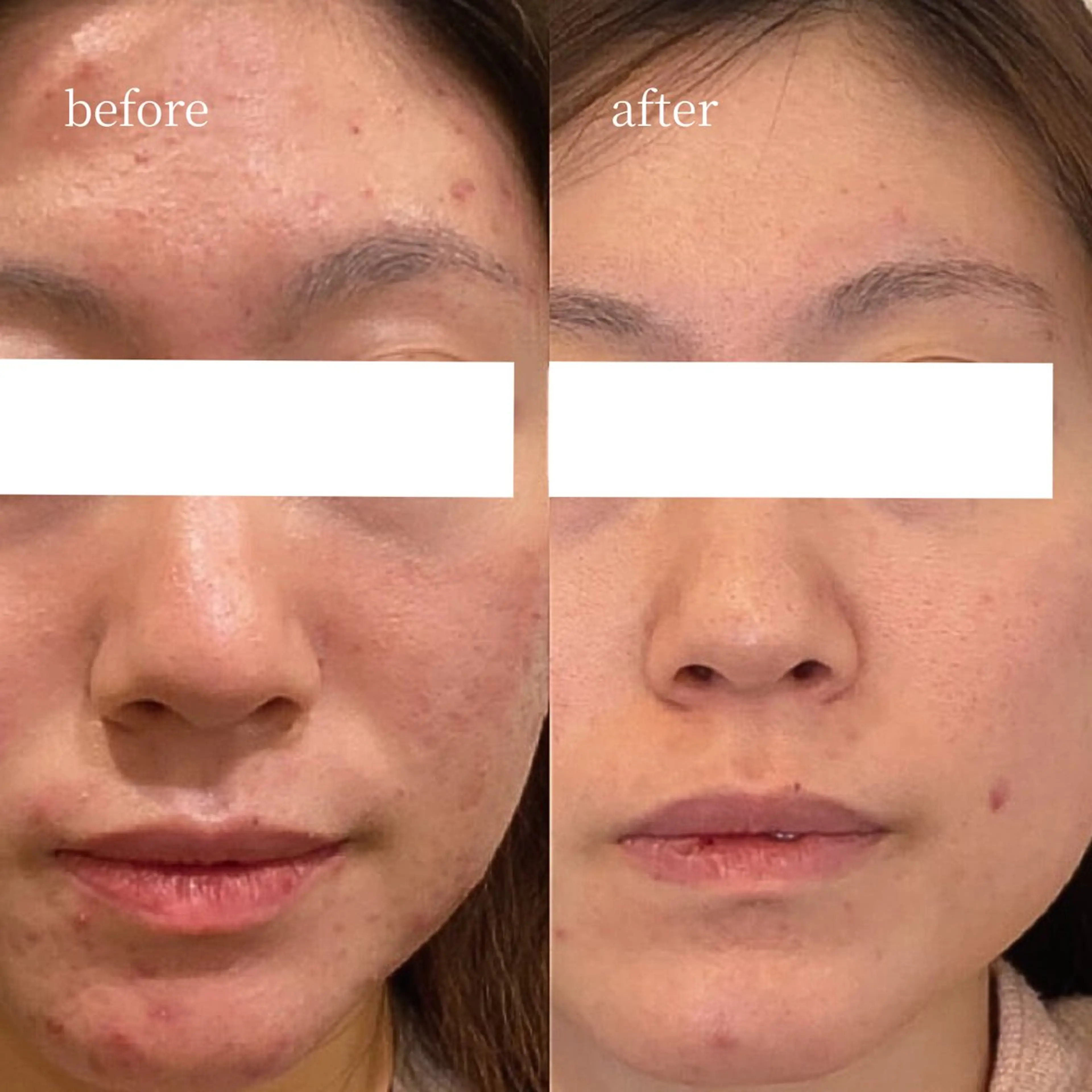 エステ 韓国肌管理・肌質改善 EARNEST心斎橋のエステ・リラクイメージ