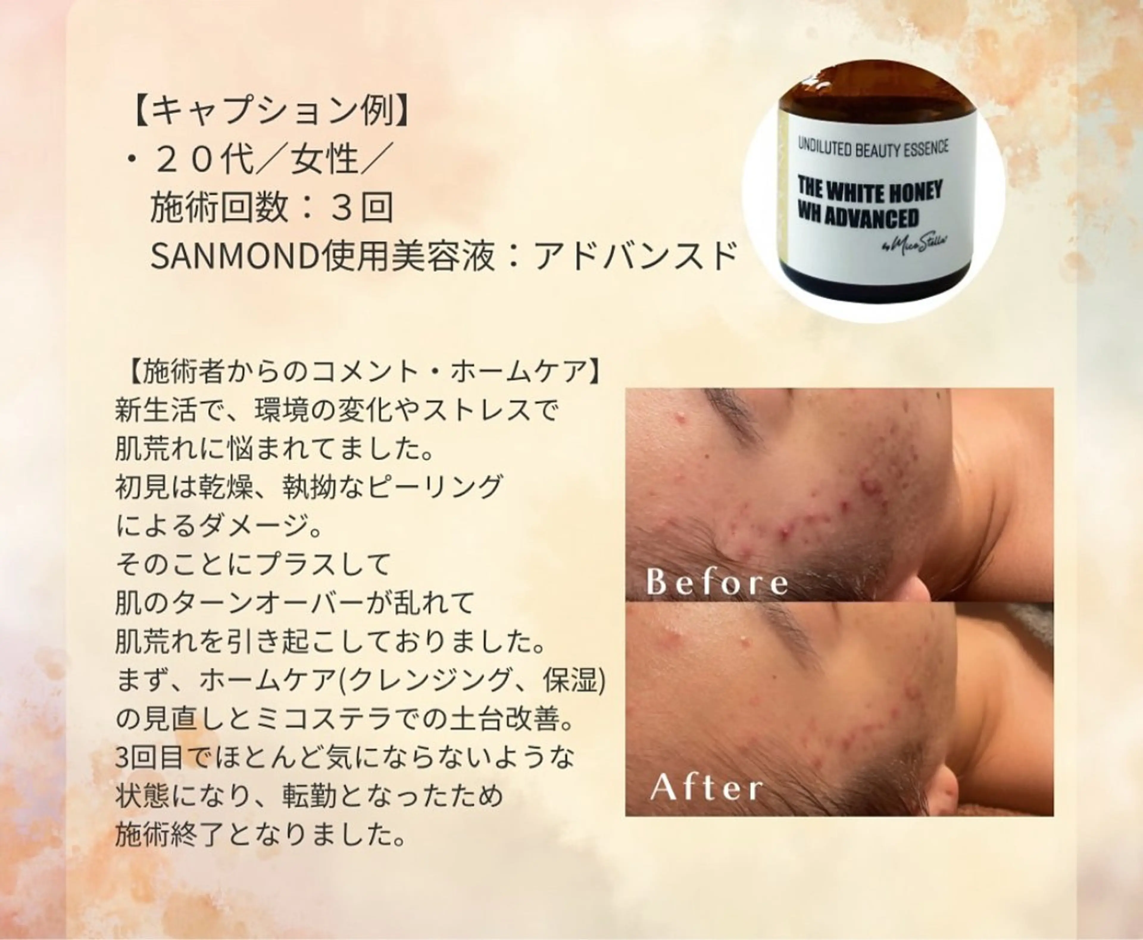 Moana【モアナ】 KARIN🫧のエステ・リラクイメージ