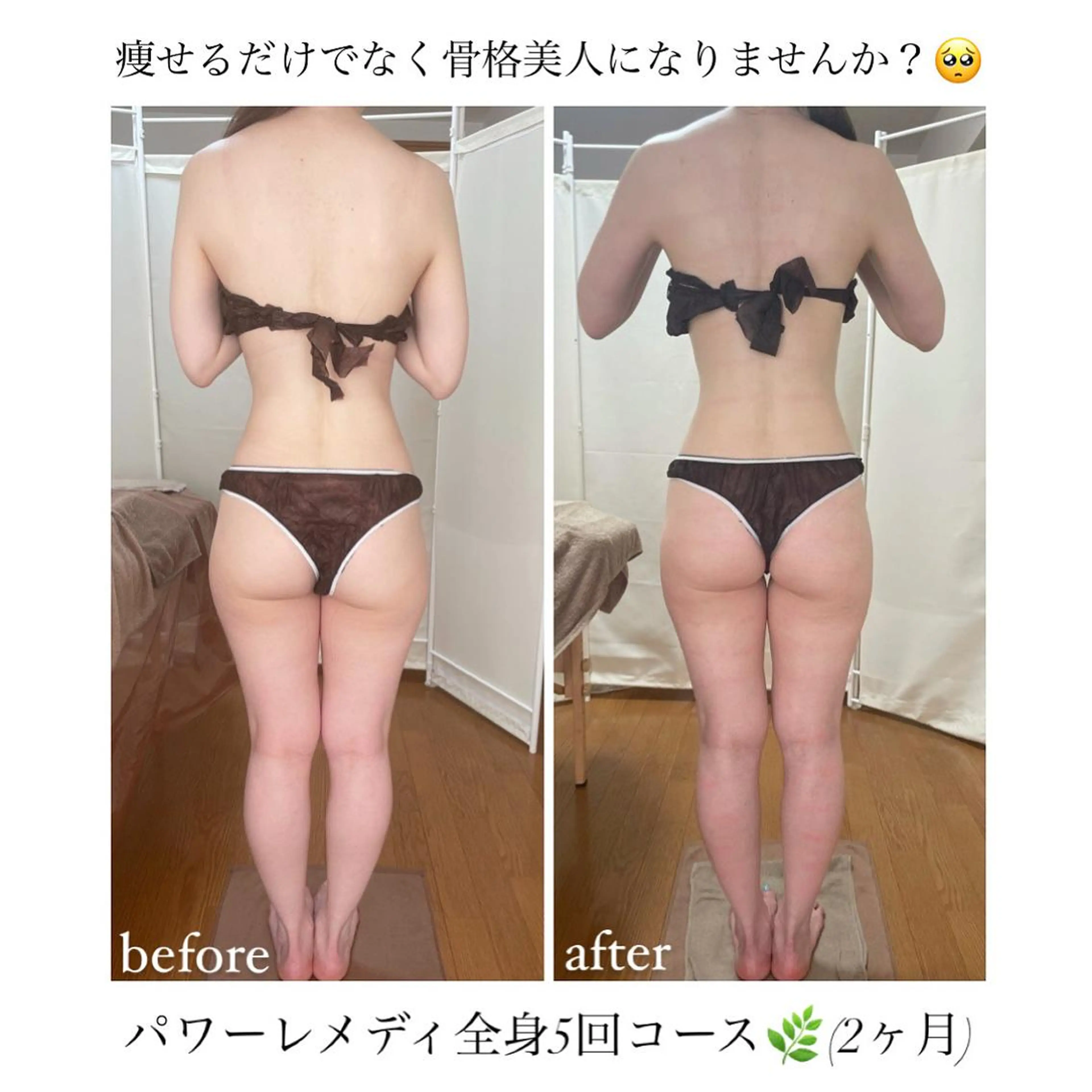 biloop所属・《痩身×疲労改善》 BILOOPのエステ・リラクイメージ