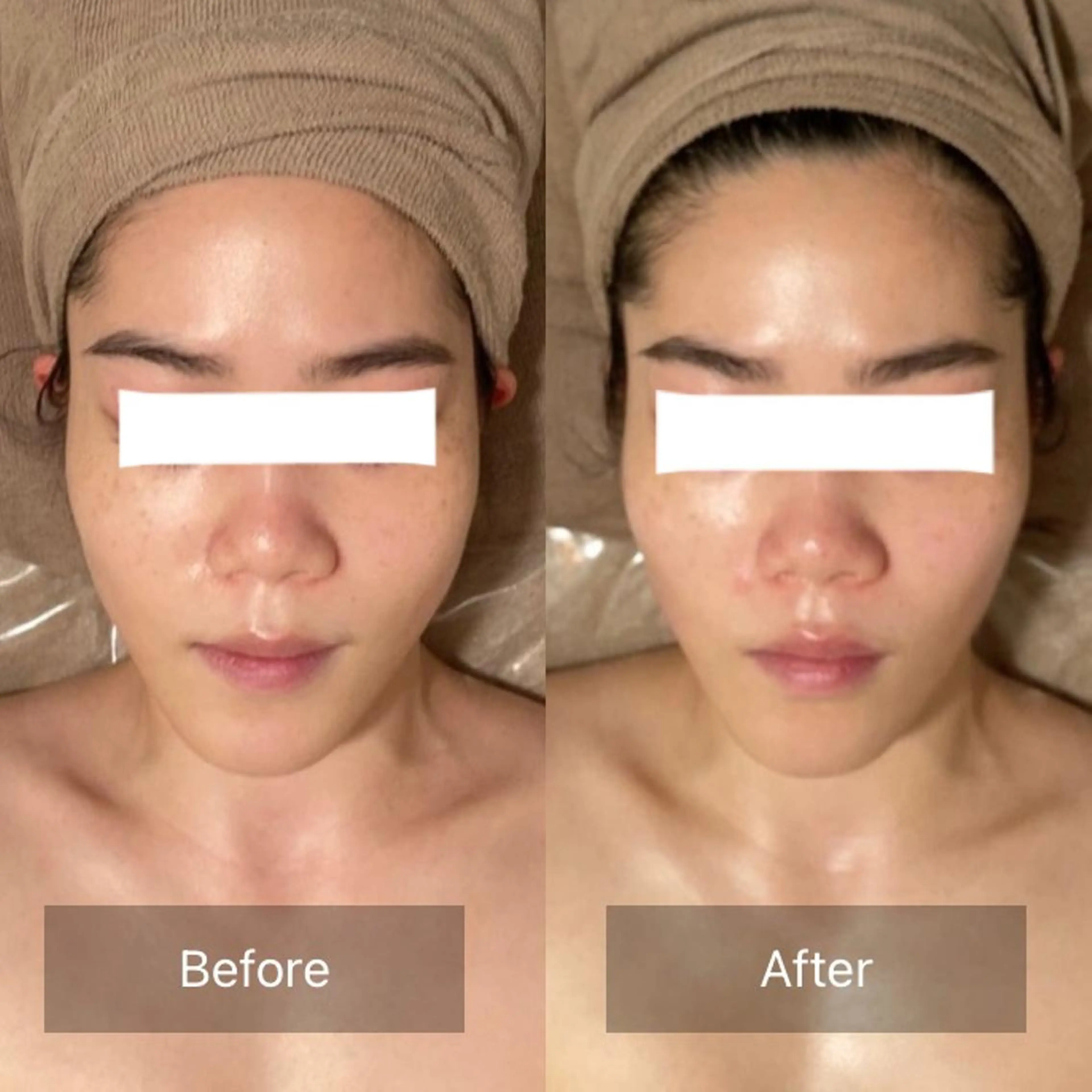 エステ リラク Ｂ&H所属・頭痛•肩こり専門/ 眉サロンB&H心斎橋のエステ・リラクイメージ