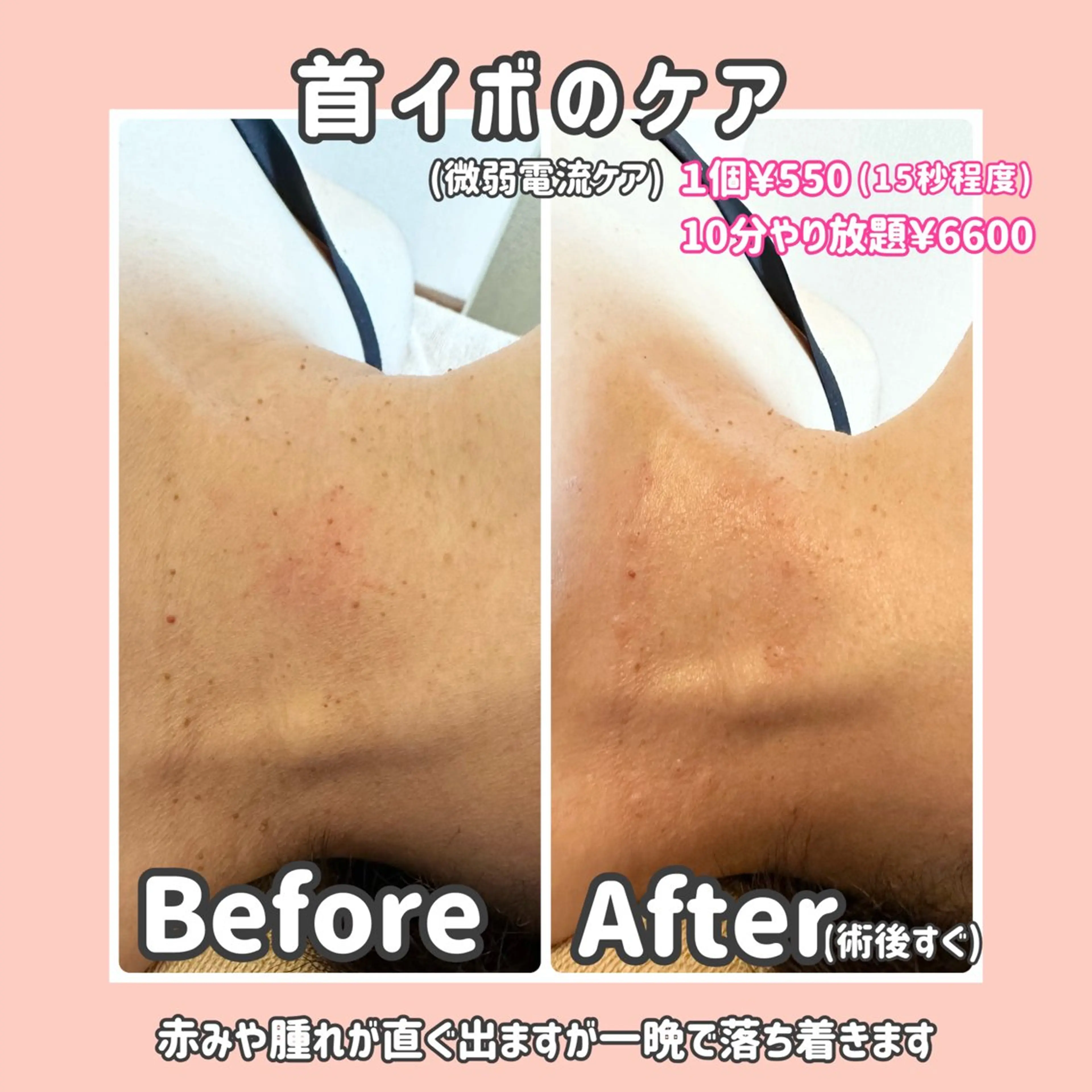 バストアップ専門/デ トックス/小顔コルギのエステ・リラクイメージ