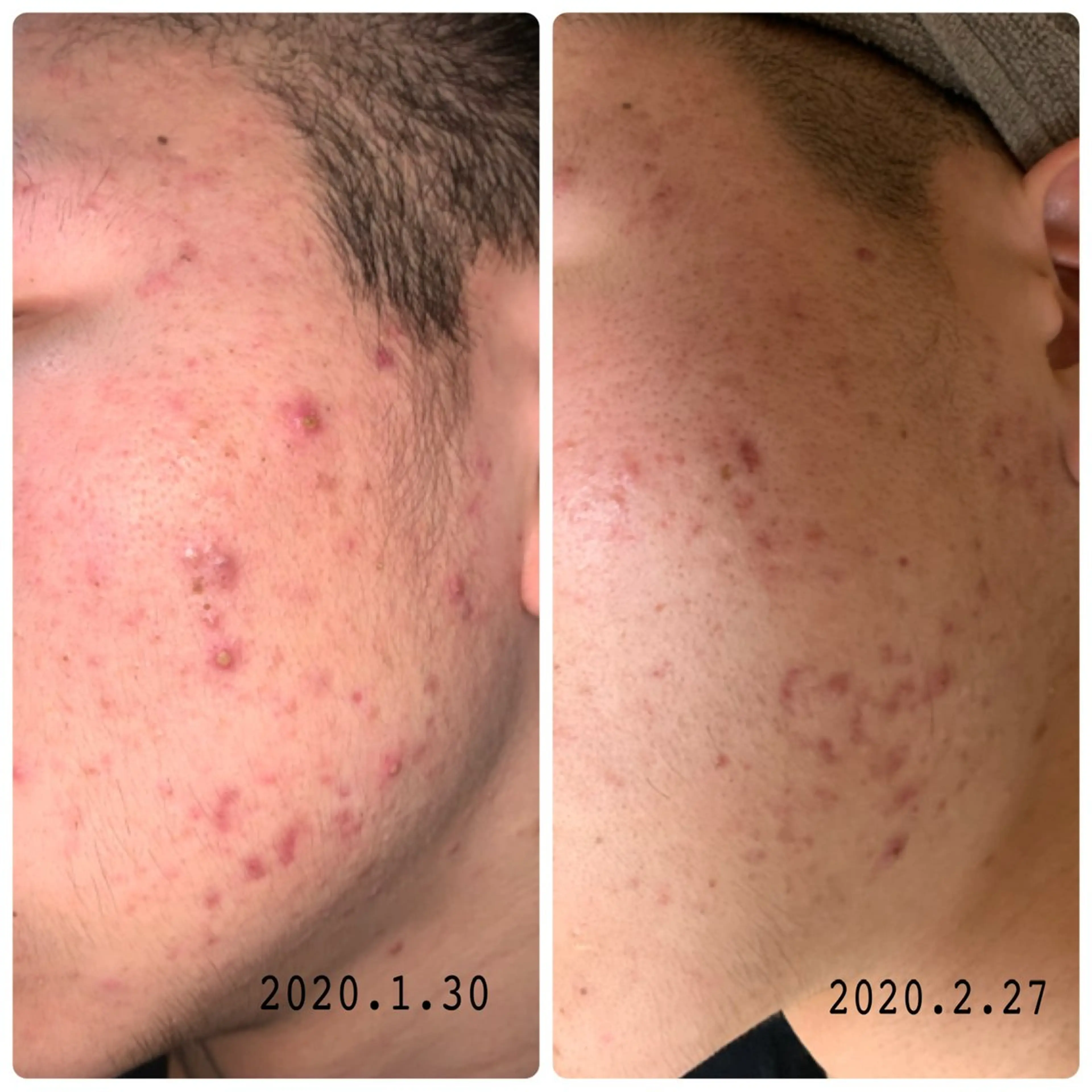 Luce所属・Luce Shokoのエステ・リラクイメージ