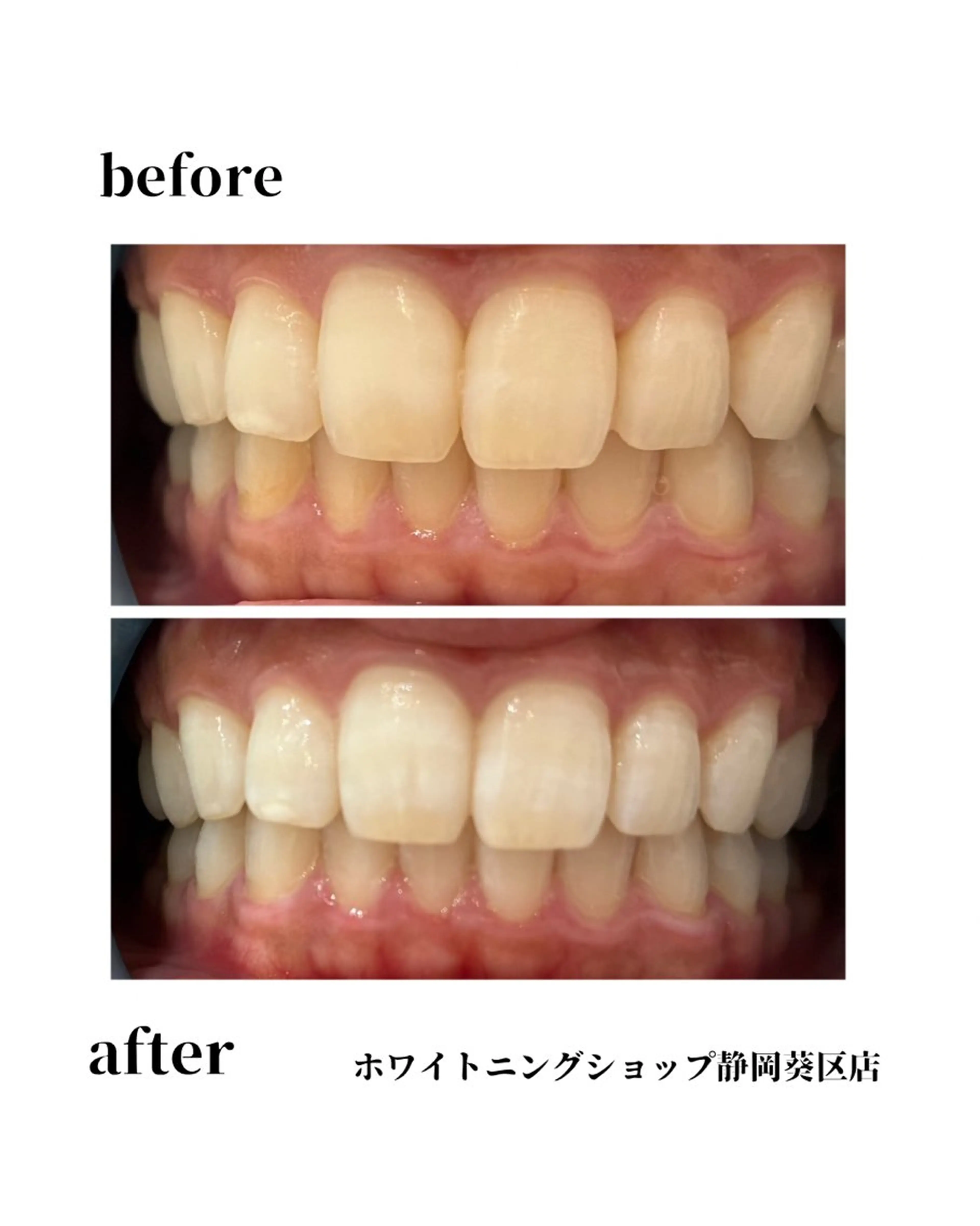 ホワイトニングショップ静岡葵区店所属・ホワイトニング ショップ葵区静岡駅店のその他イメージ