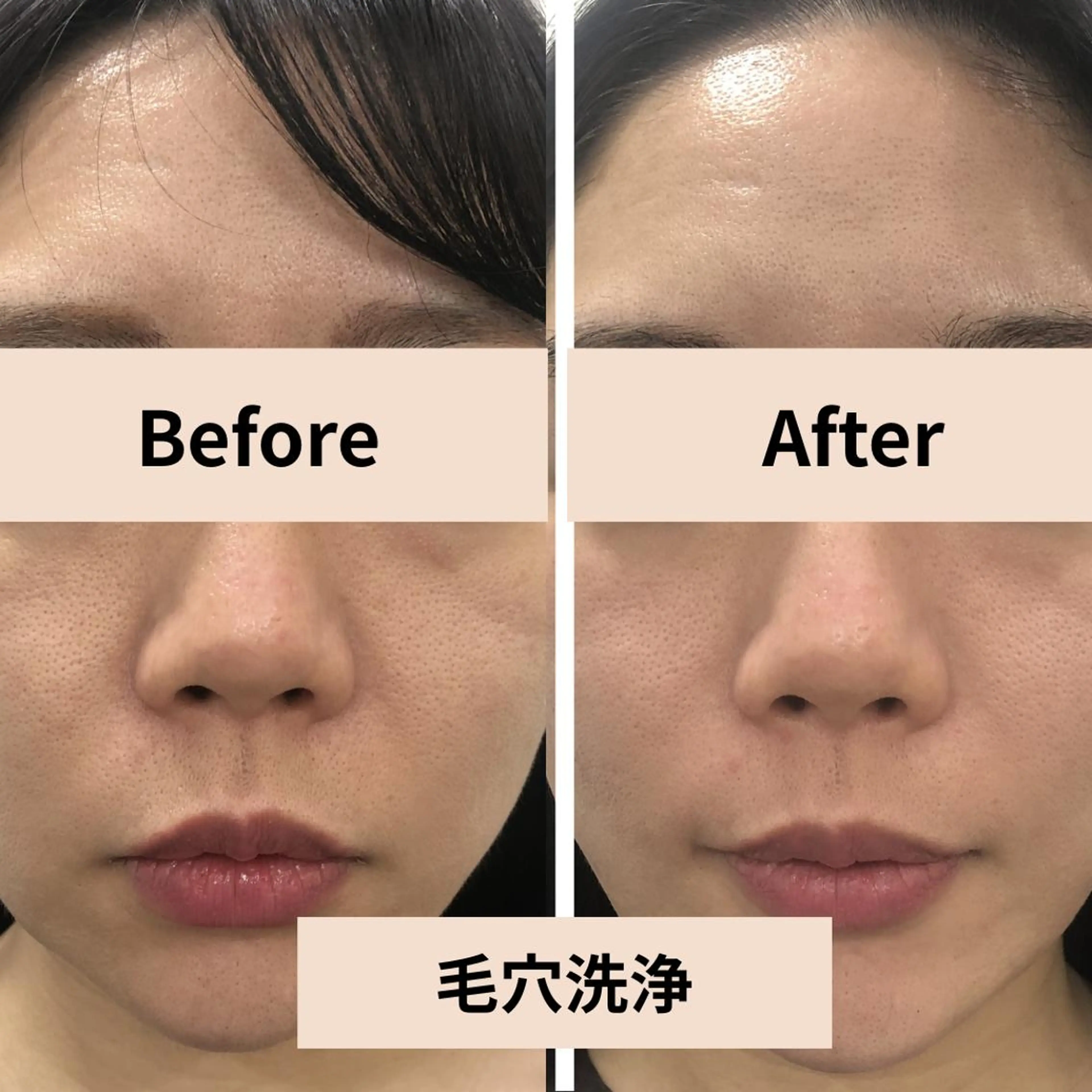 【小顔・毛穴ケア】 セラピスト 和田紋子のエステ・リラクイメージ