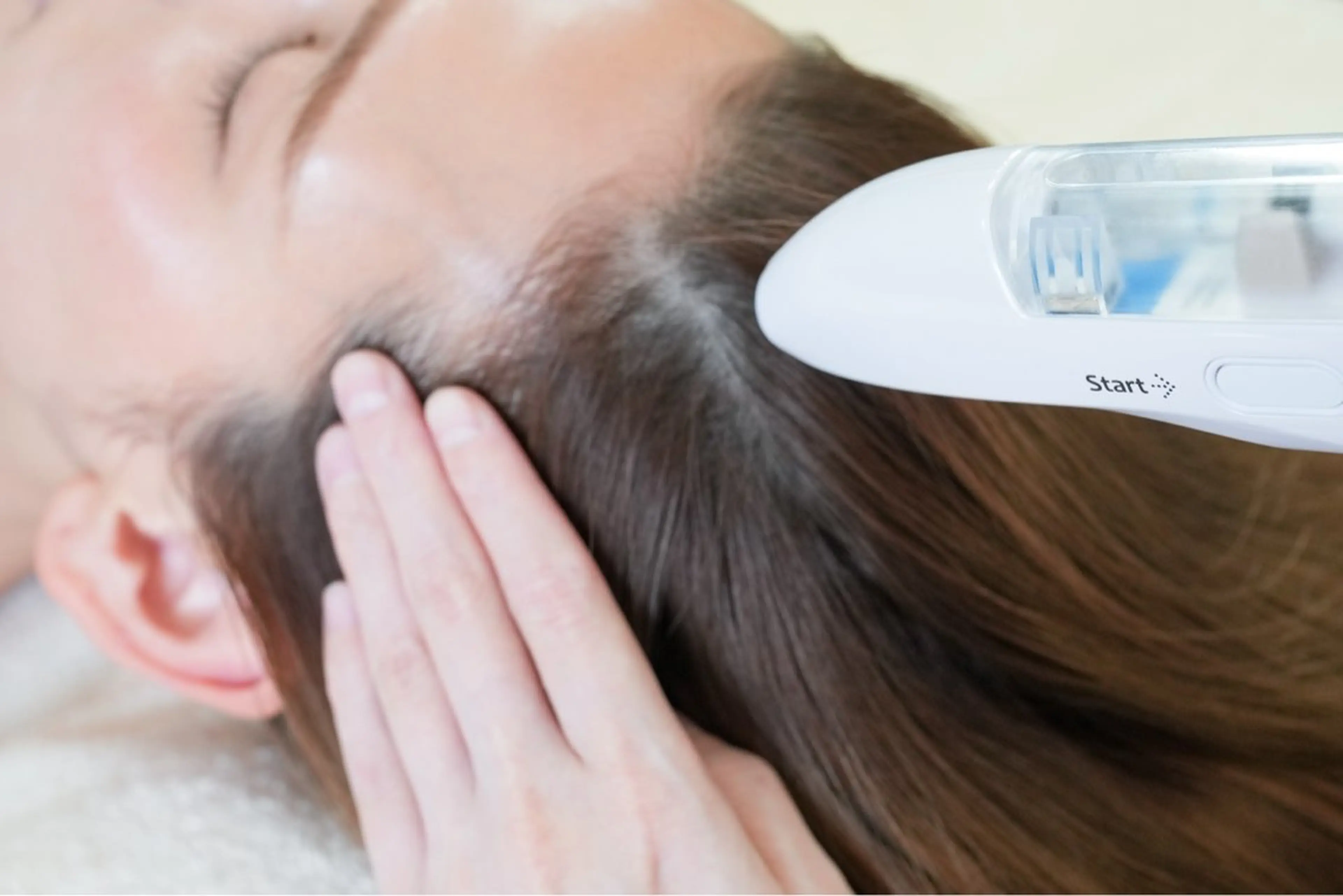 【変化がわかる育毛促進！】毛染めが面倒…抜け毛も気になりだしたあなたへの写真