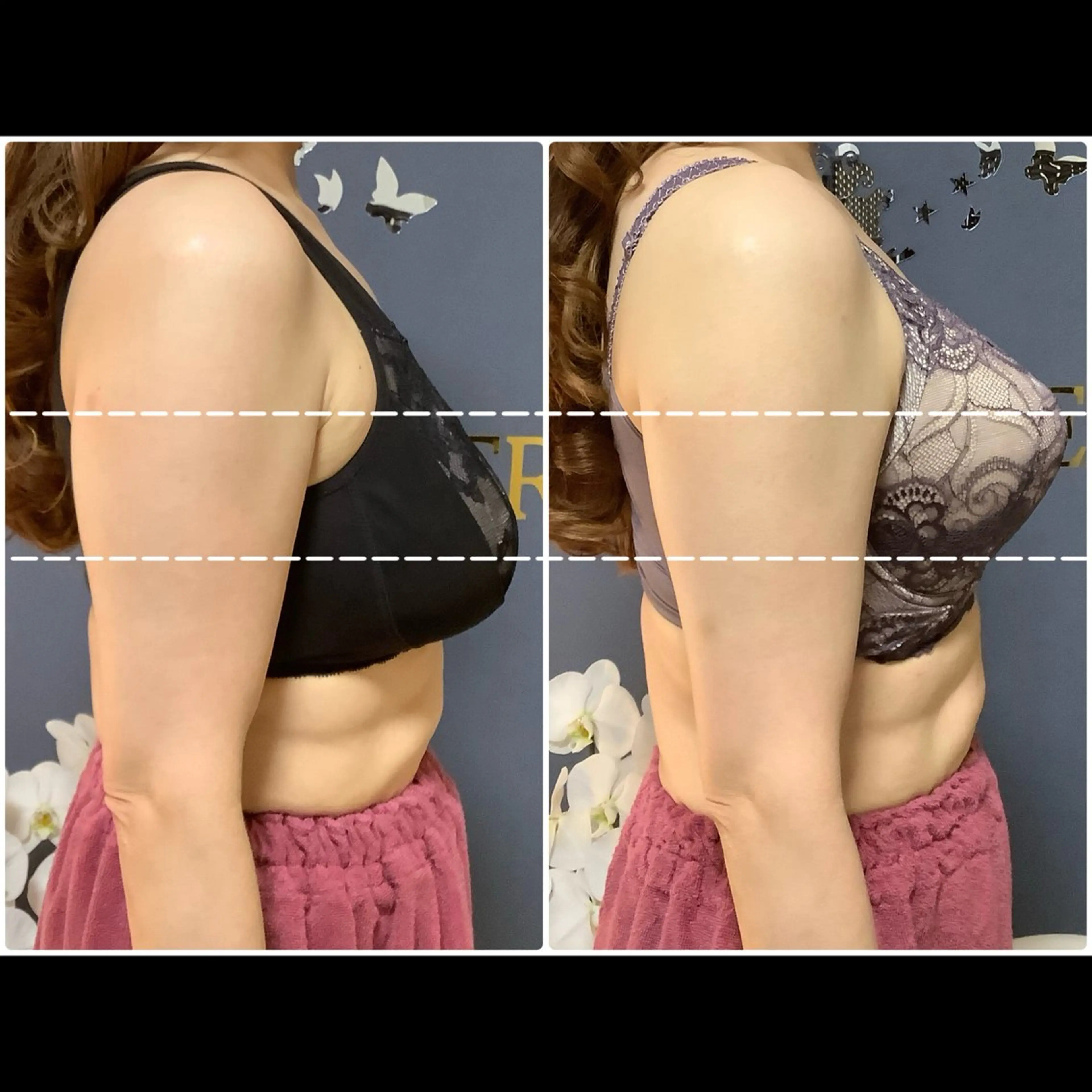 バストアップサロン Feerie：フェリのエステ・リラクイメージ