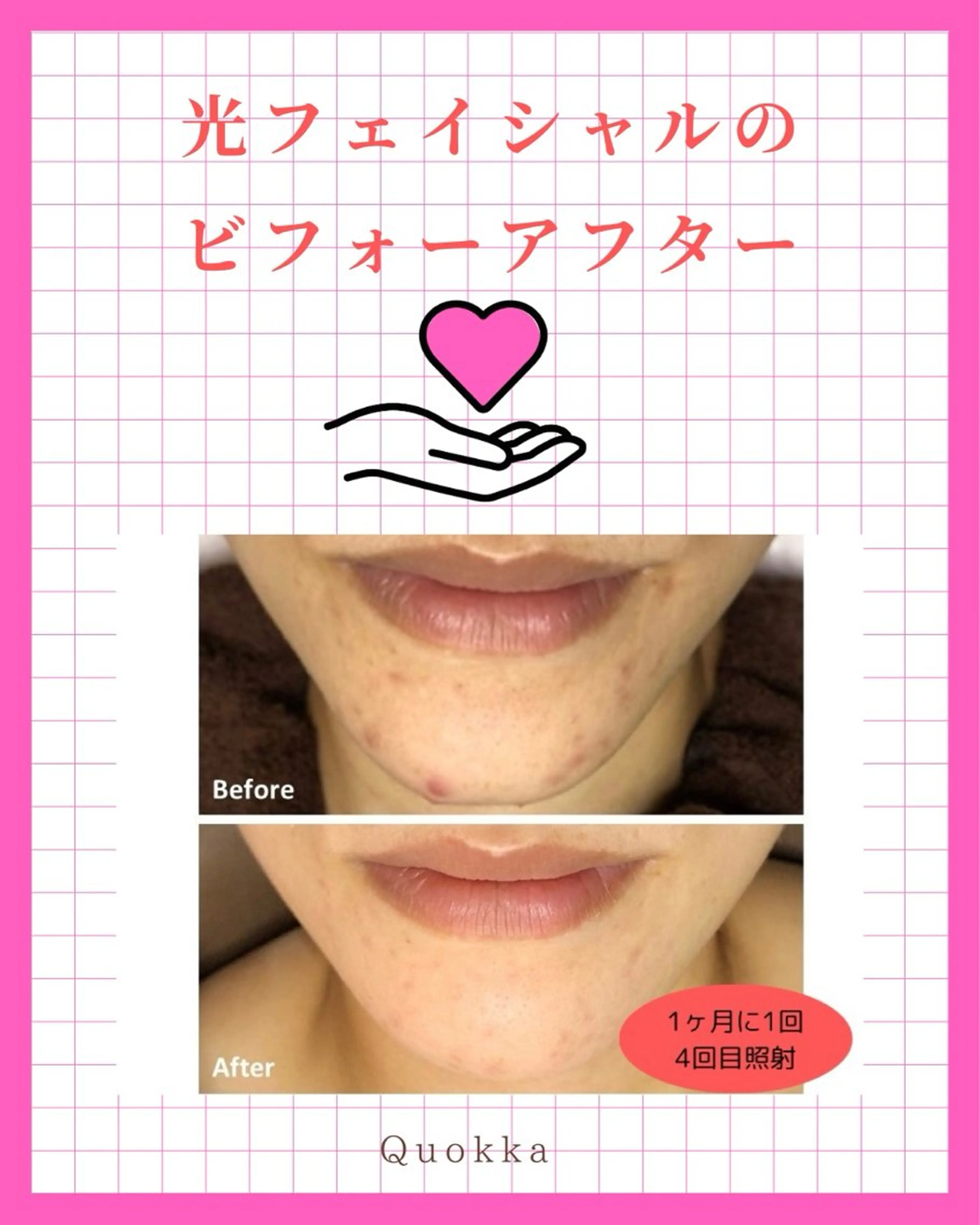 エステ Quokka ✴︎ あま市甚目寺のエステ・リラクイメージ