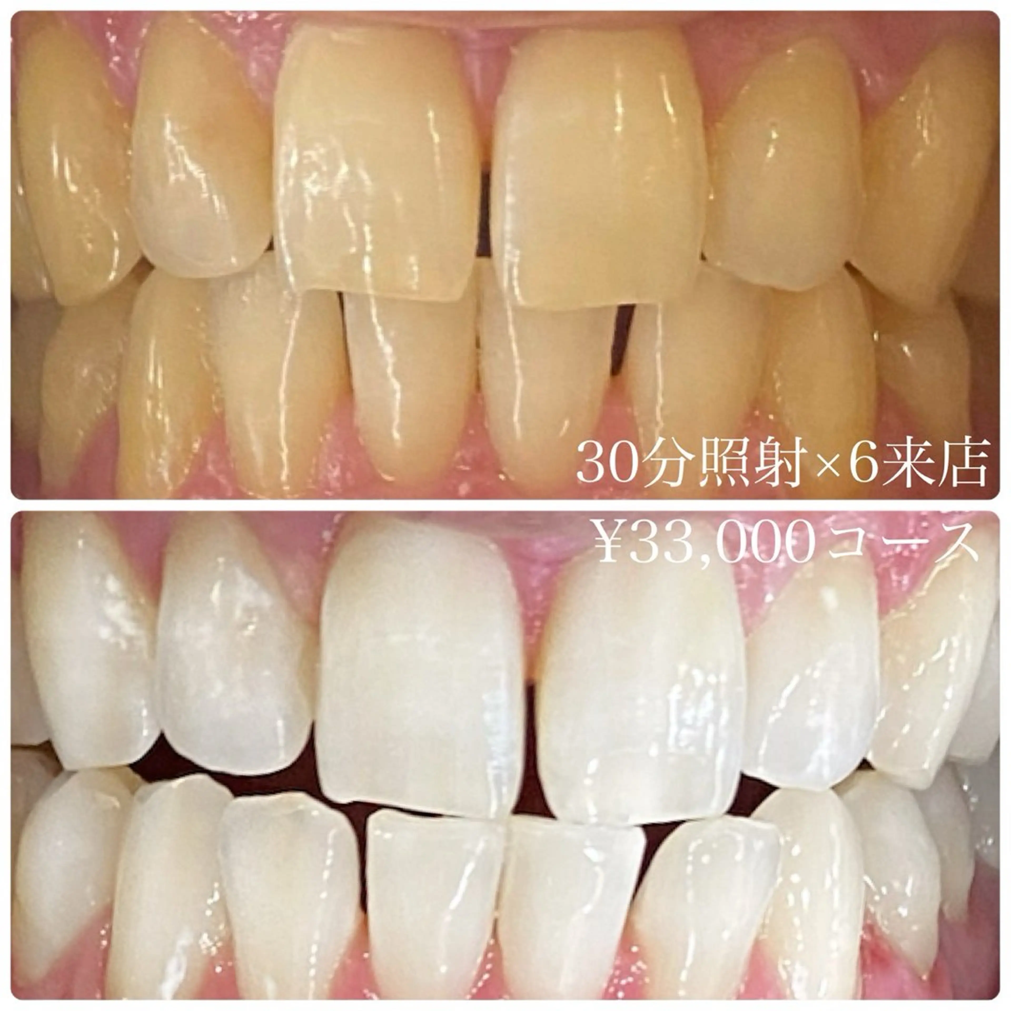 PLATINUM Beauty 横浜店所属・ホワイトニングルーム 横浜店のその他イメージ