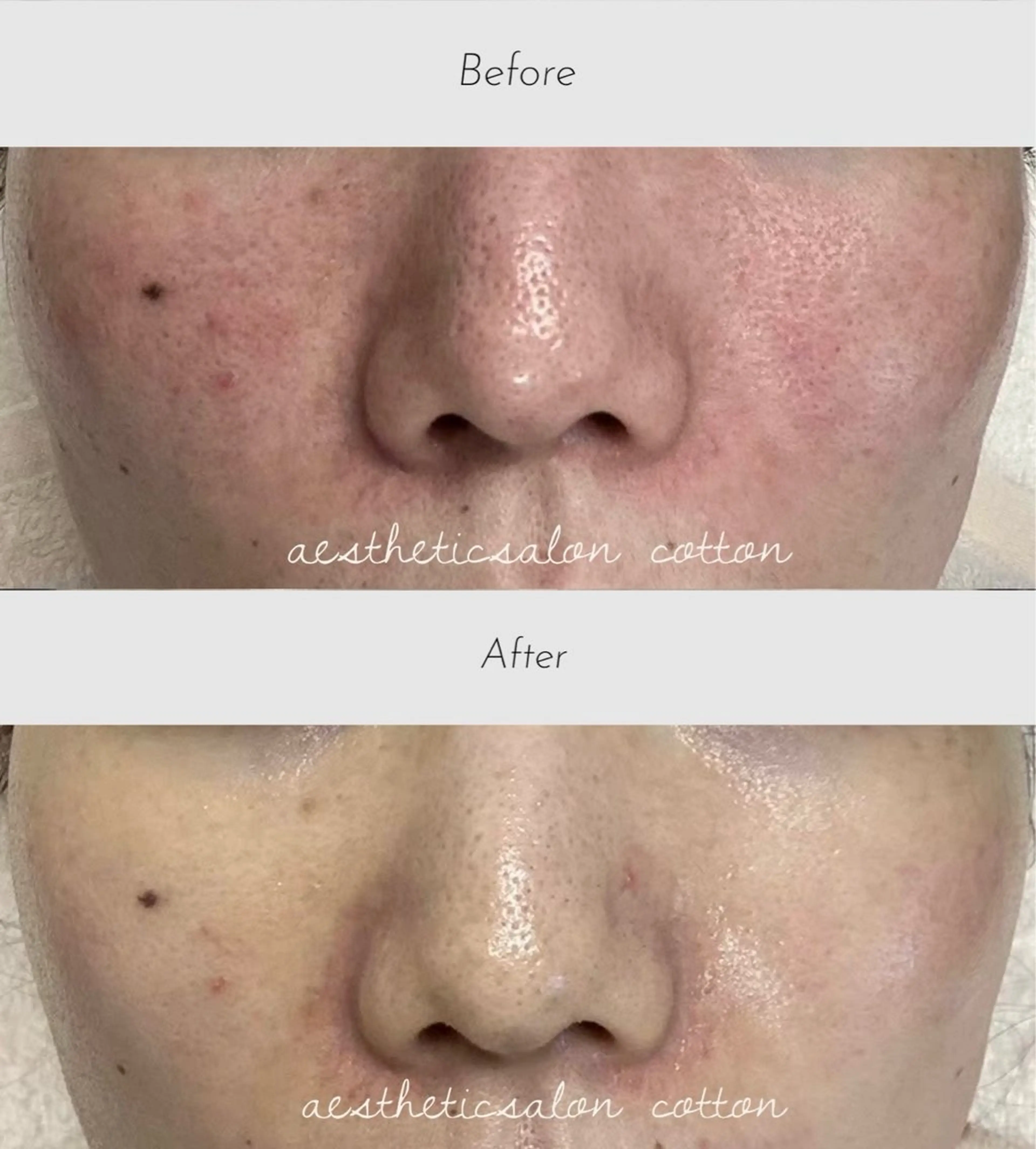 エステ 都度払い 肌質改善専門サロンのエステ・リラクイメージ