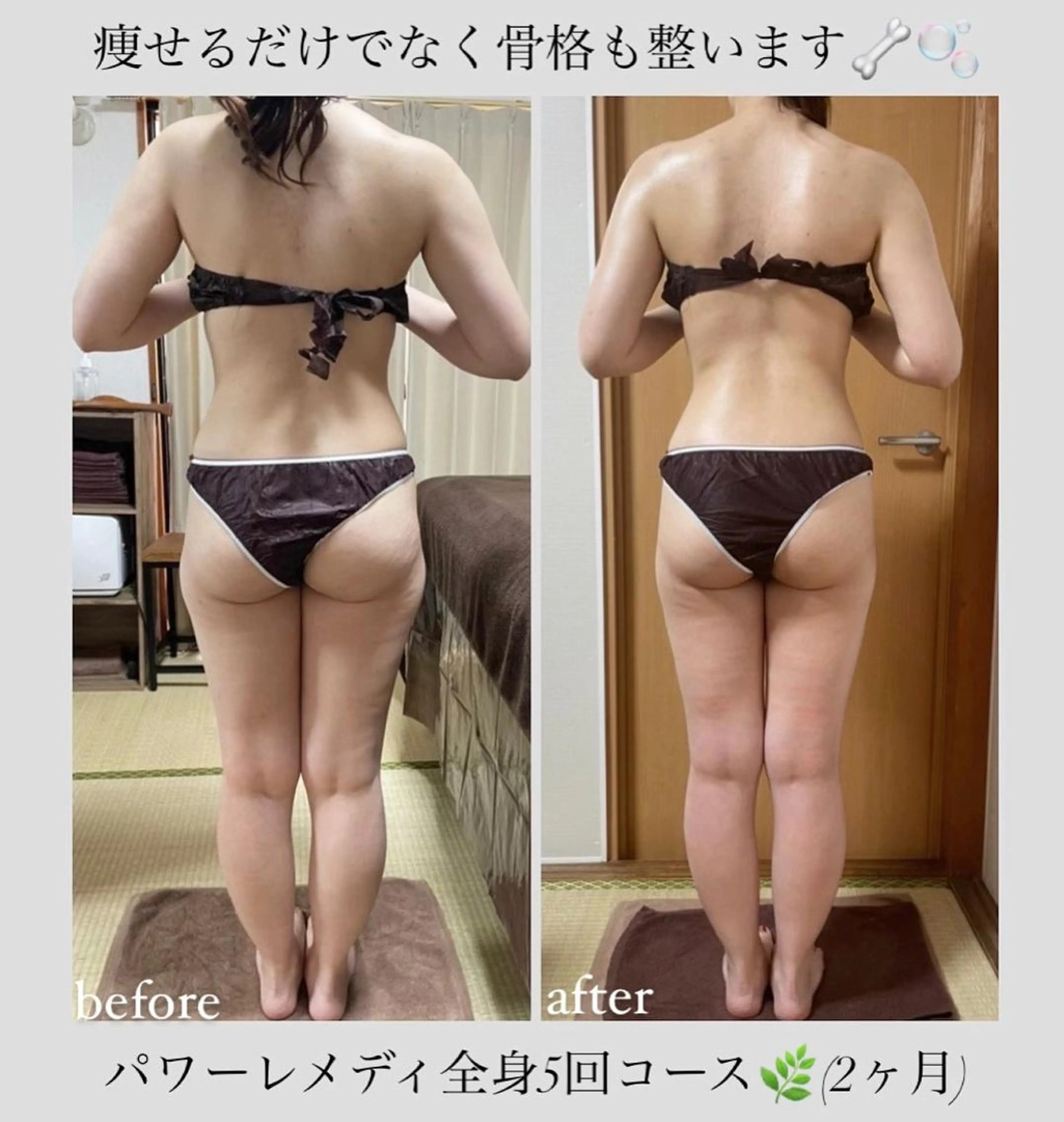 biloop所属・《本気痩せ×疲労改善 》  BILOOPのエステ・リラクイメージ