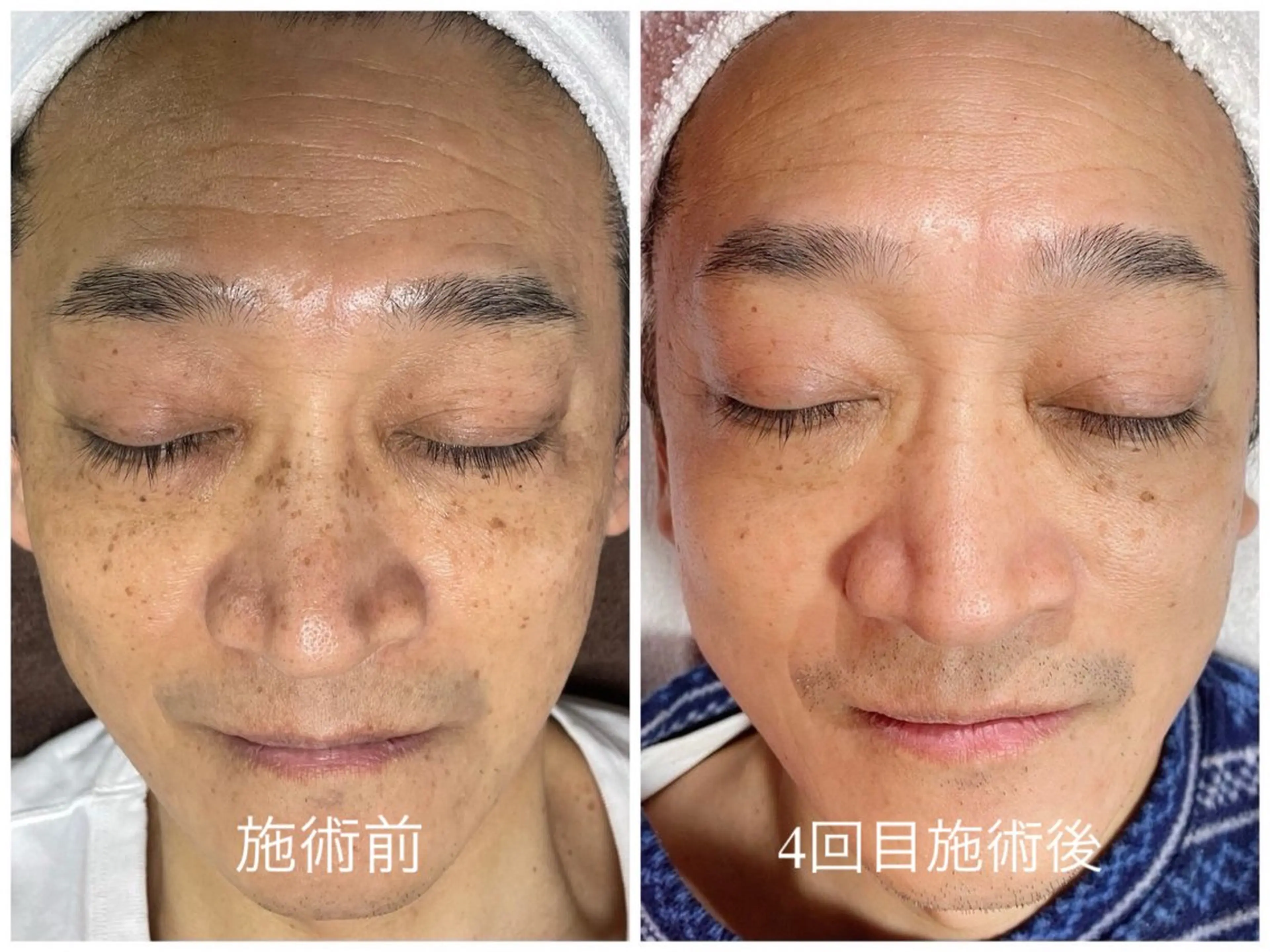 メンズ エステ スリーエスプラス内　美肌サロンEme所属・希映 -kieのエステ・リラクイメージ