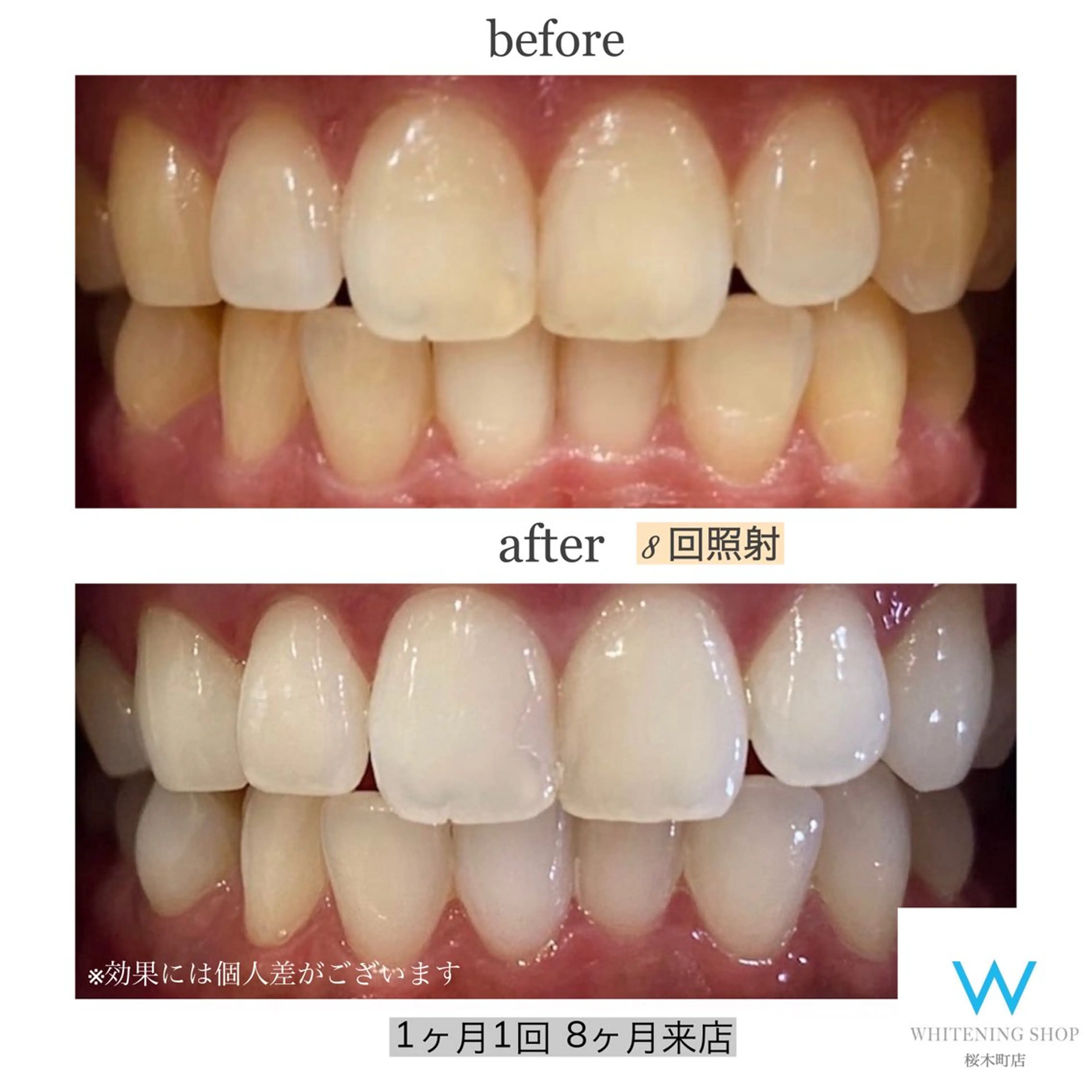 その他 ホワイトニングショップ桜木町店所属・ホワイトニング ショップ桜木町店のエステ・リラクイメージ