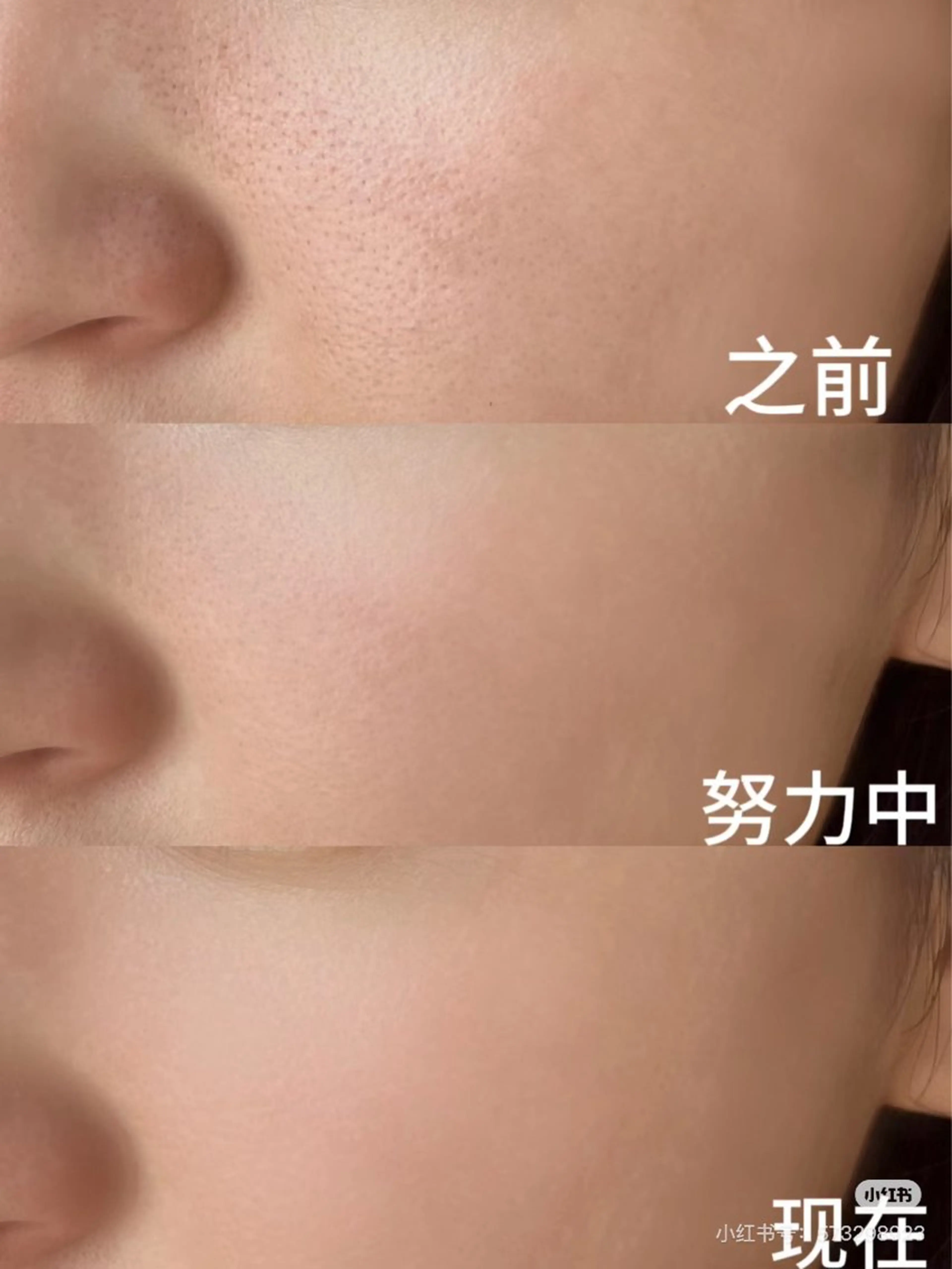 マツエク・マツパ エステ aliaハイフ&水光ジェットサロン所属・aliaハーブ水光店 エステティシャン募集のエステ・リラクイメージ