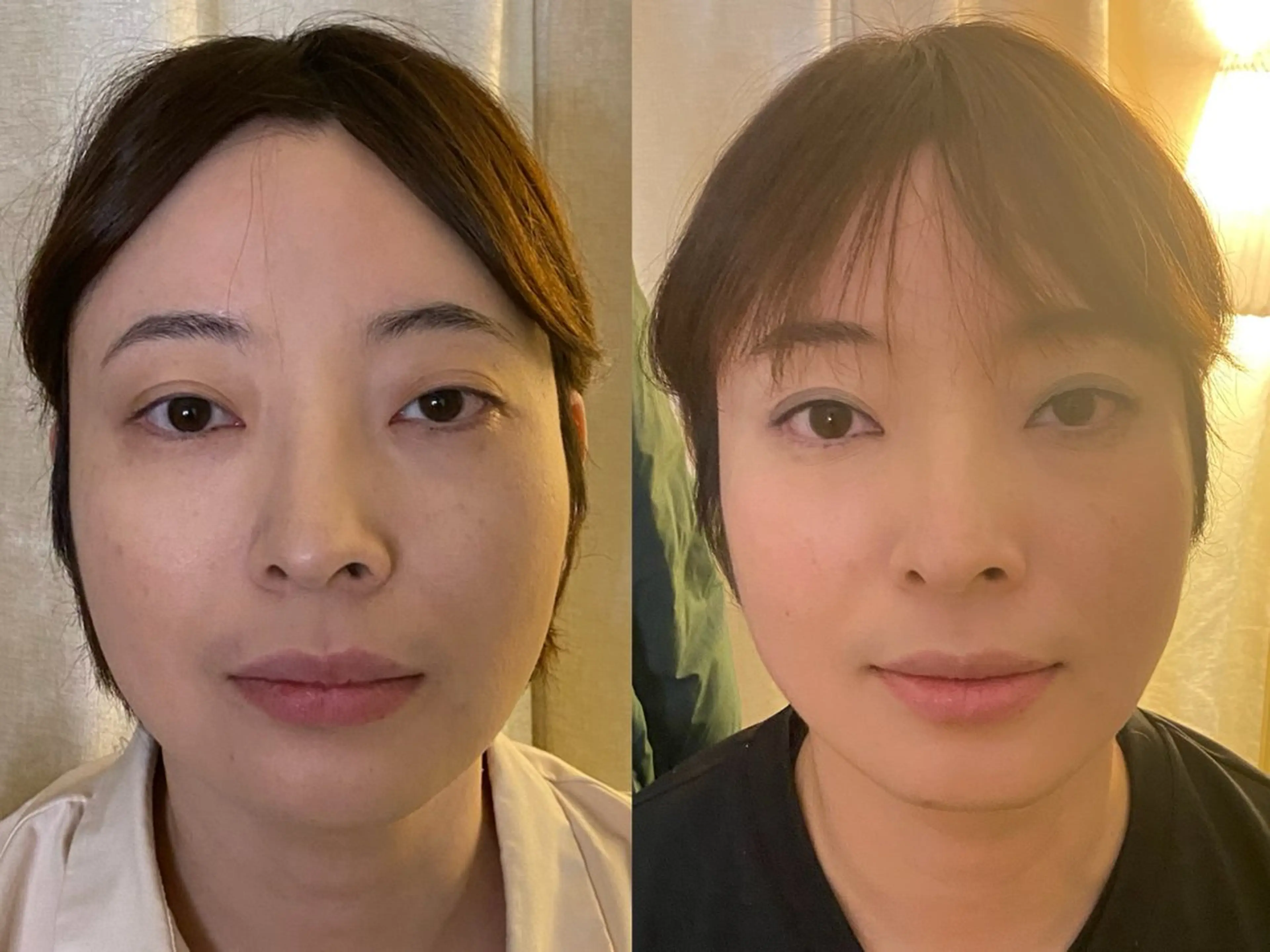 99-KUKU-所属・天神美容鍼99 -KUKU-吉弘萌香のエステ・リラクイメージ