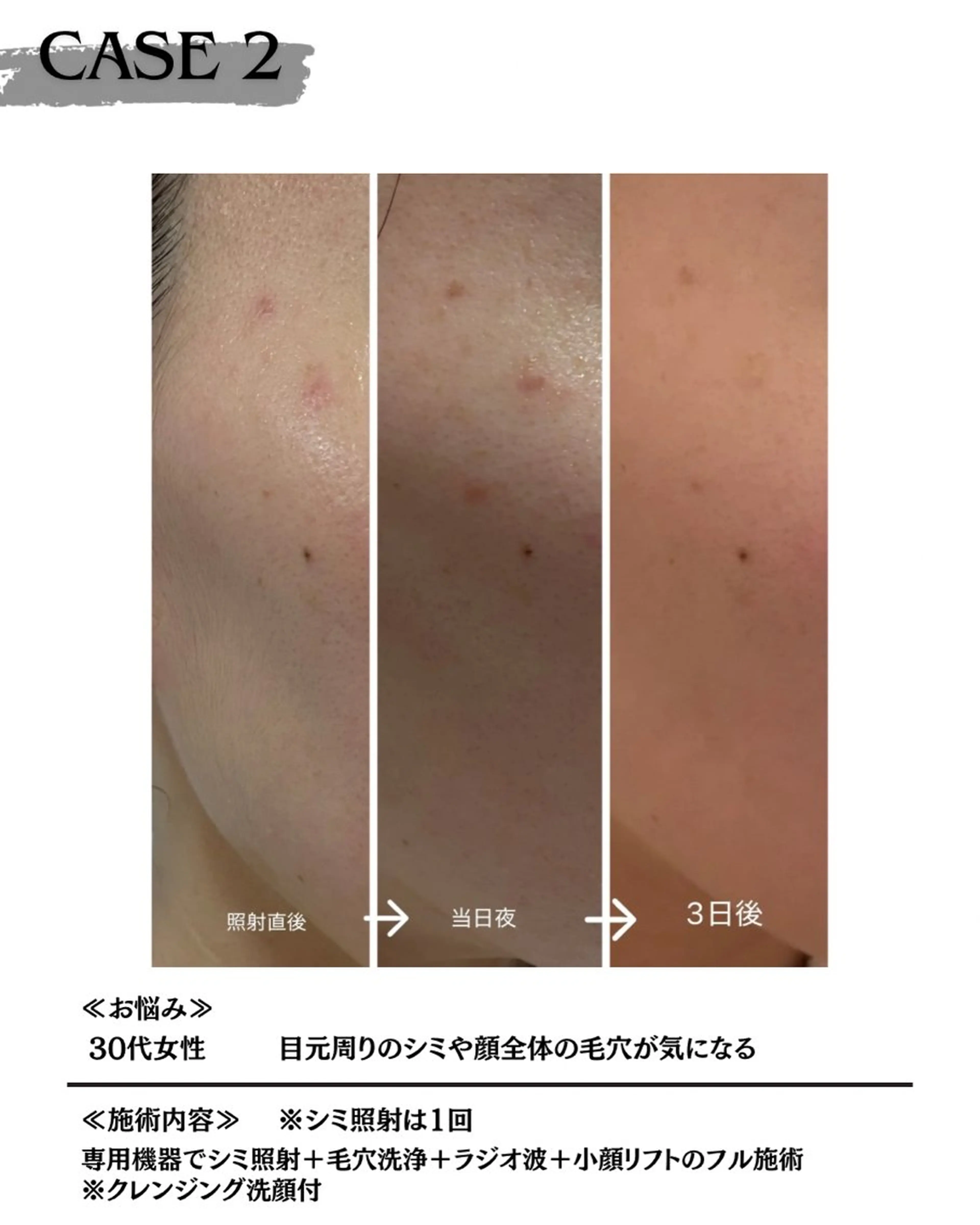 エステ 素肌育成・シミケア専門サロン美潤-miulu-所属・【医療提携サロン】 【シミケア専門】のエステ・リラクイメージ