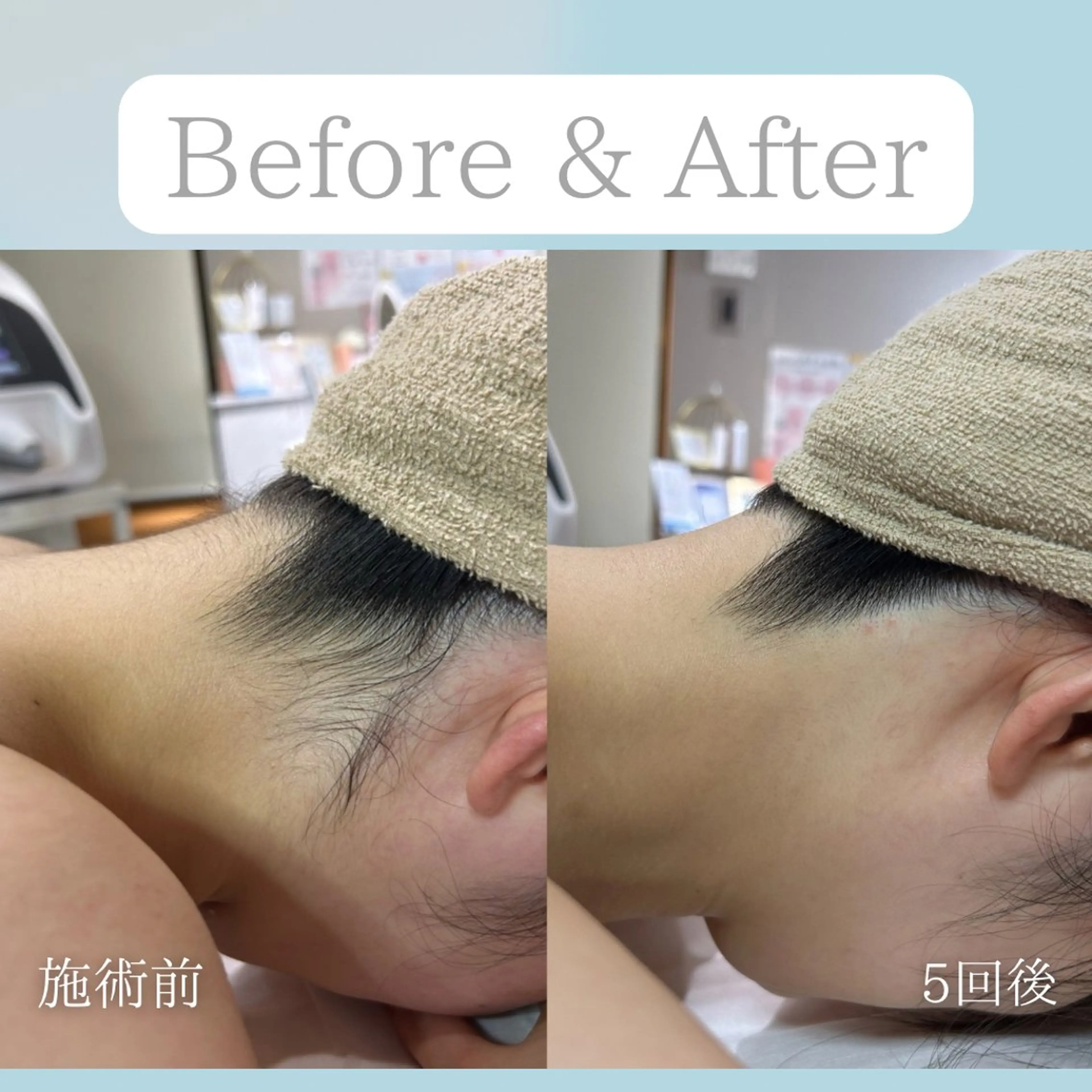 美肌脱毛&毛穴専門 Nico🐰ྀི♡のエステ・リラクイメージ