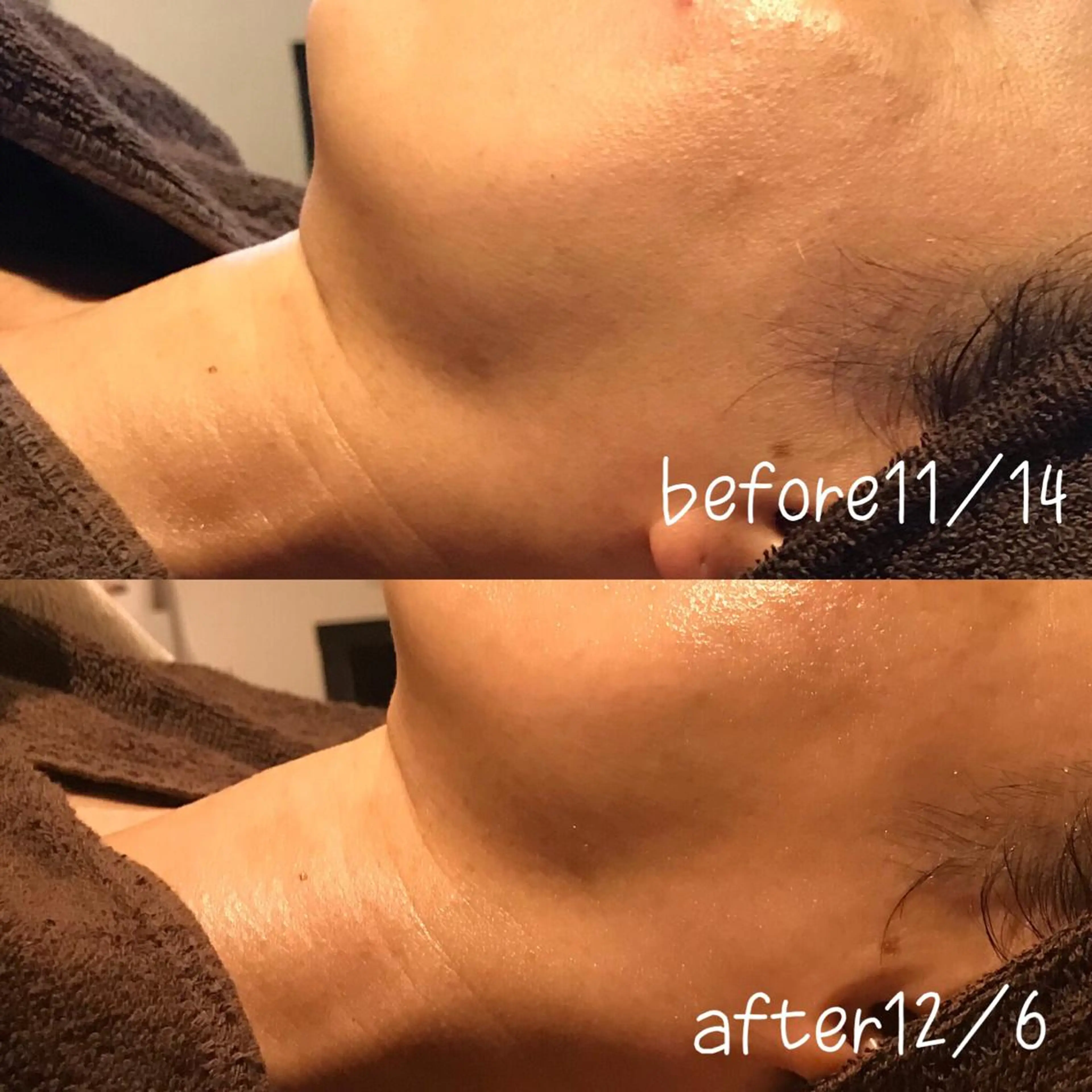 エステ 浜野 恵美のエステ・リラクイメージ