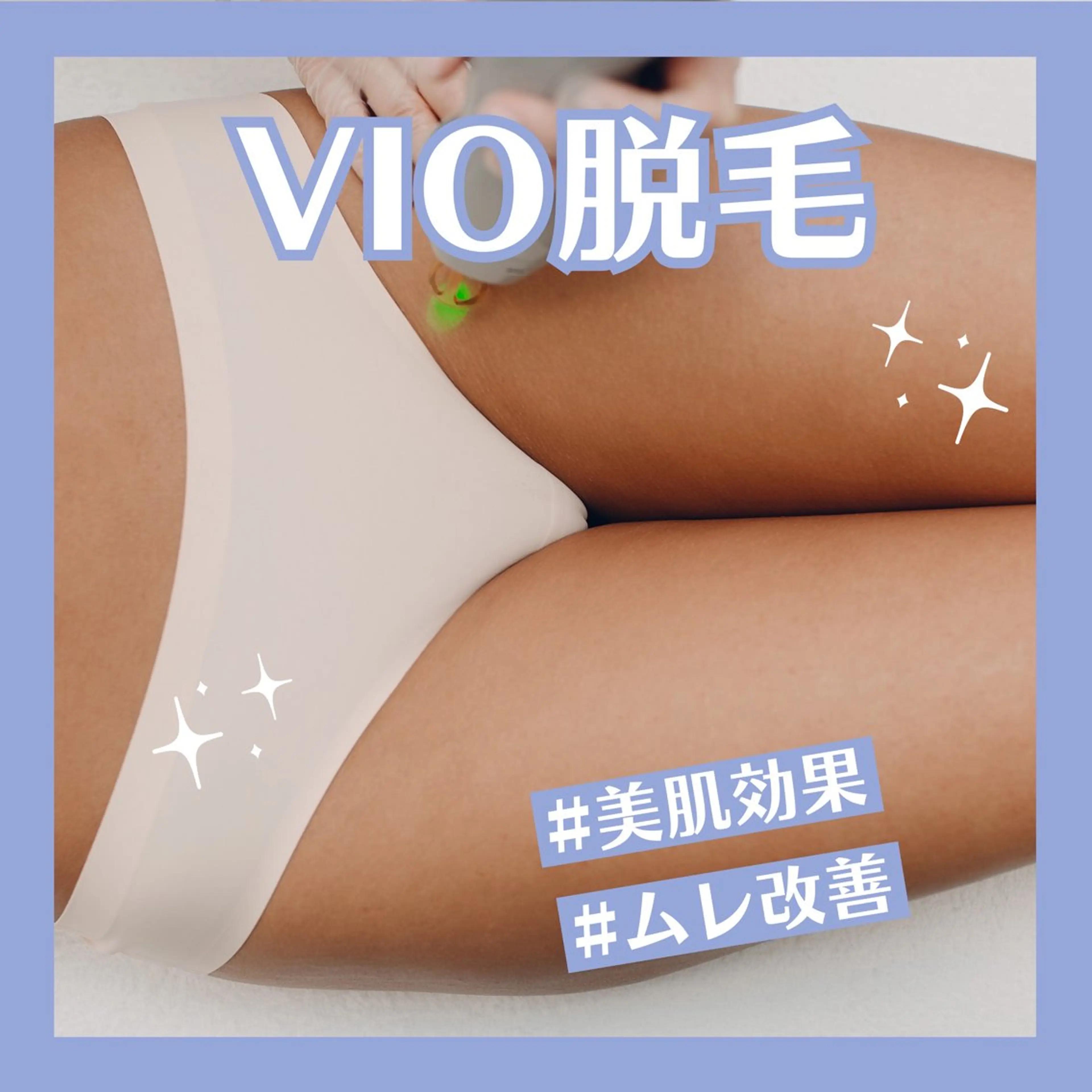 VIO脱毛セットの写真