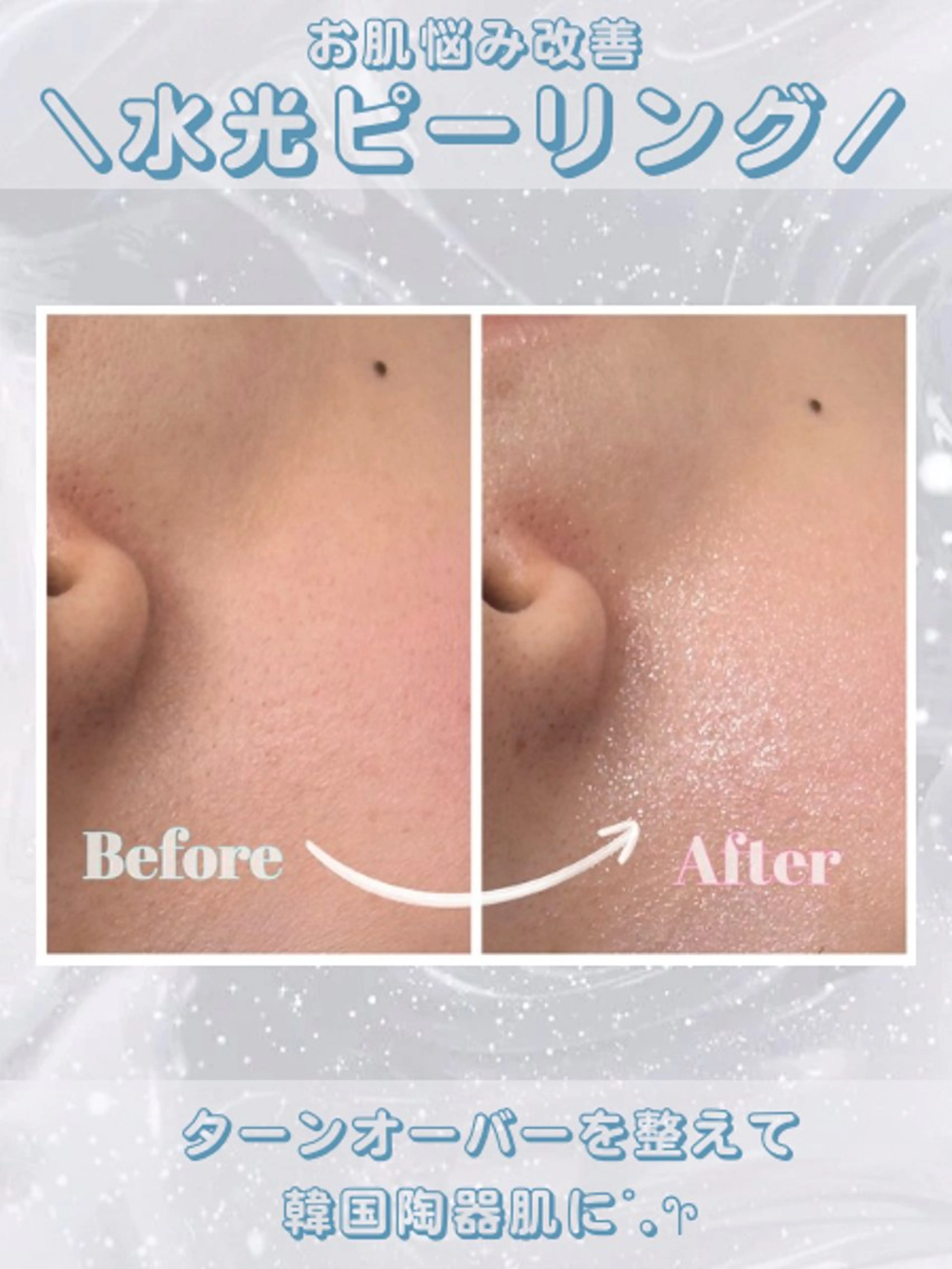 エステ レイビス盛岡店 ♡吉田♡のエステ・リラクイメージ