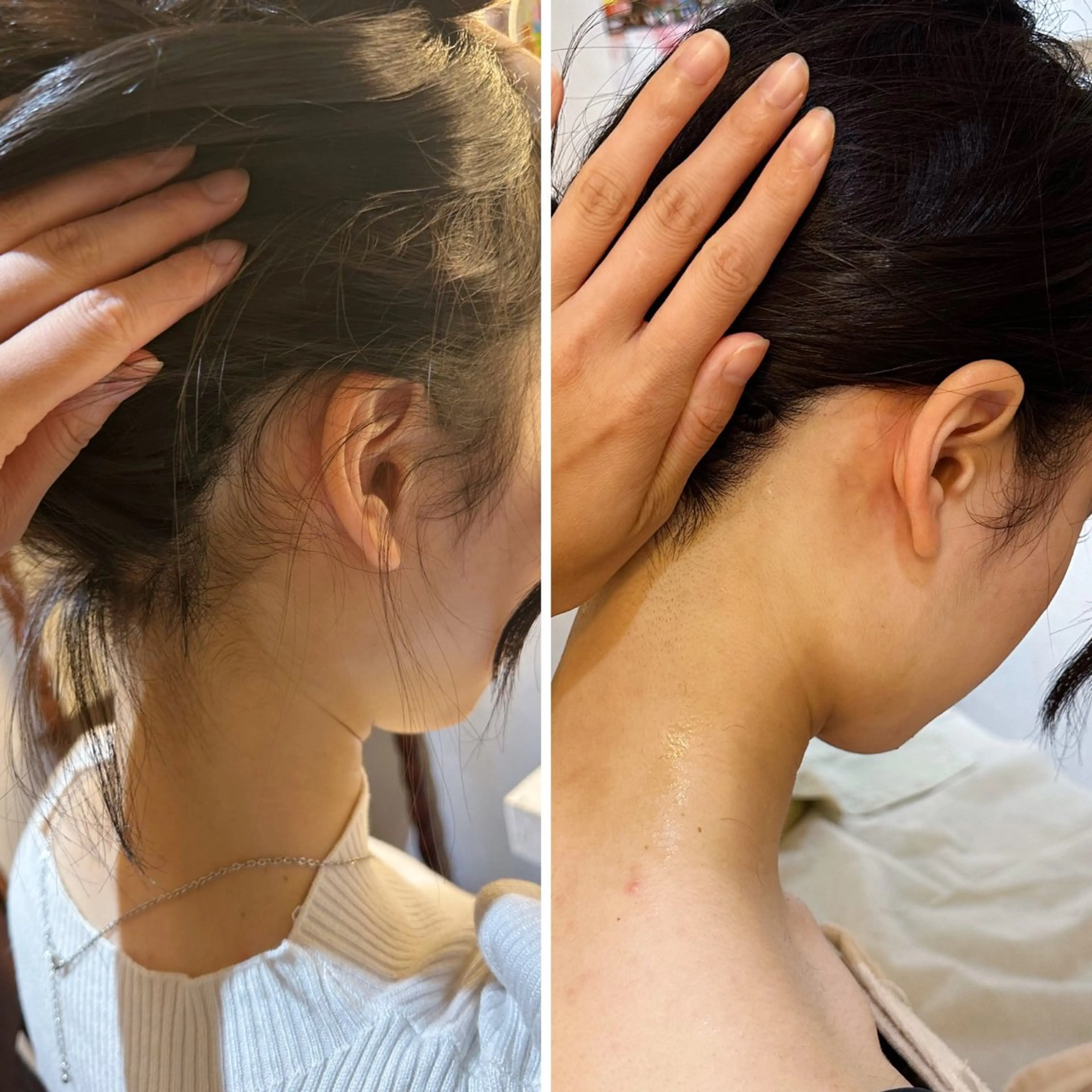 脱毛 うなじ脱毛/美肌脱毛 LABELのエステ・リラクイメージ