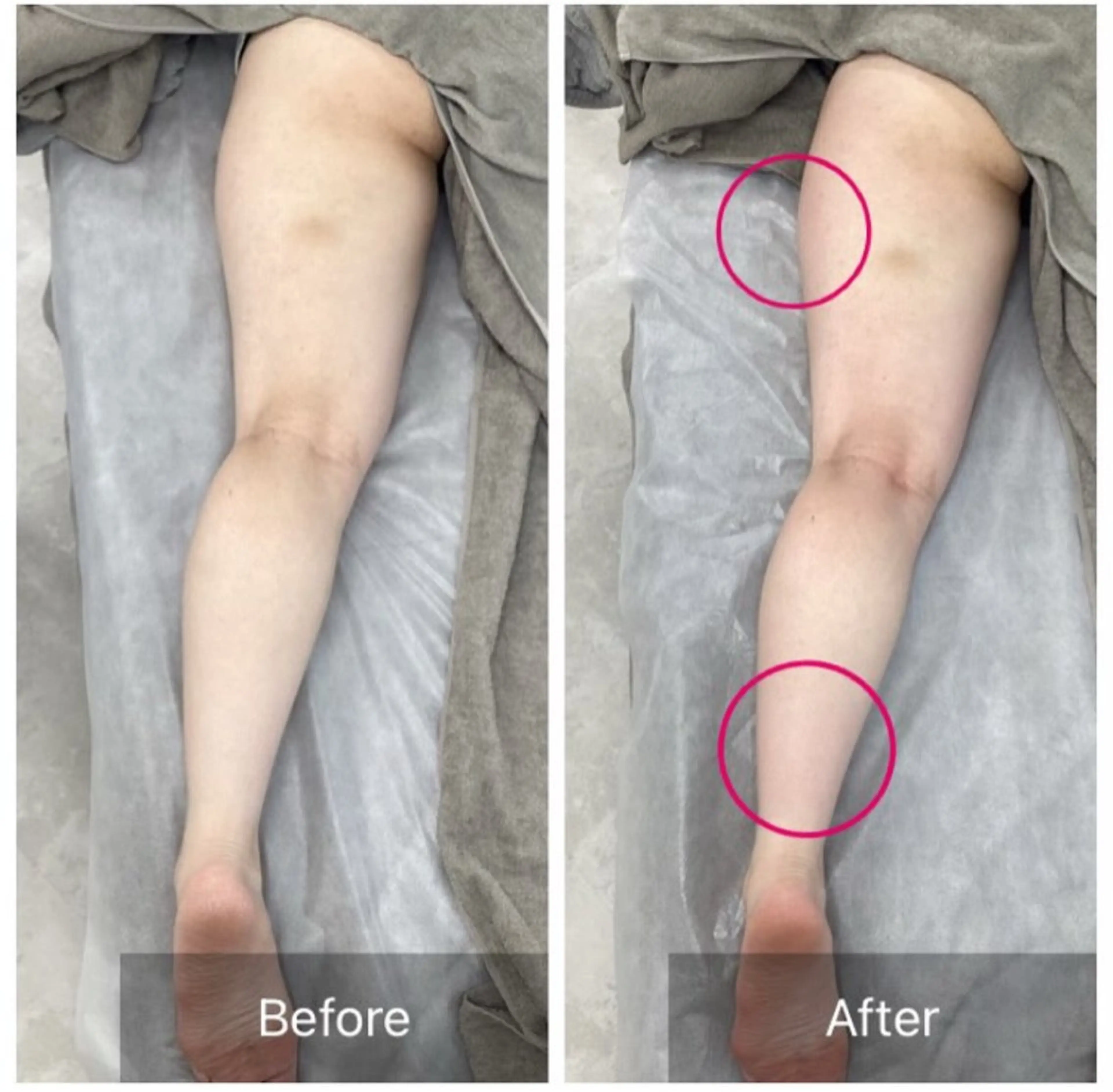 エステ Dahlia Nakaoのエステ・リラクイメージ