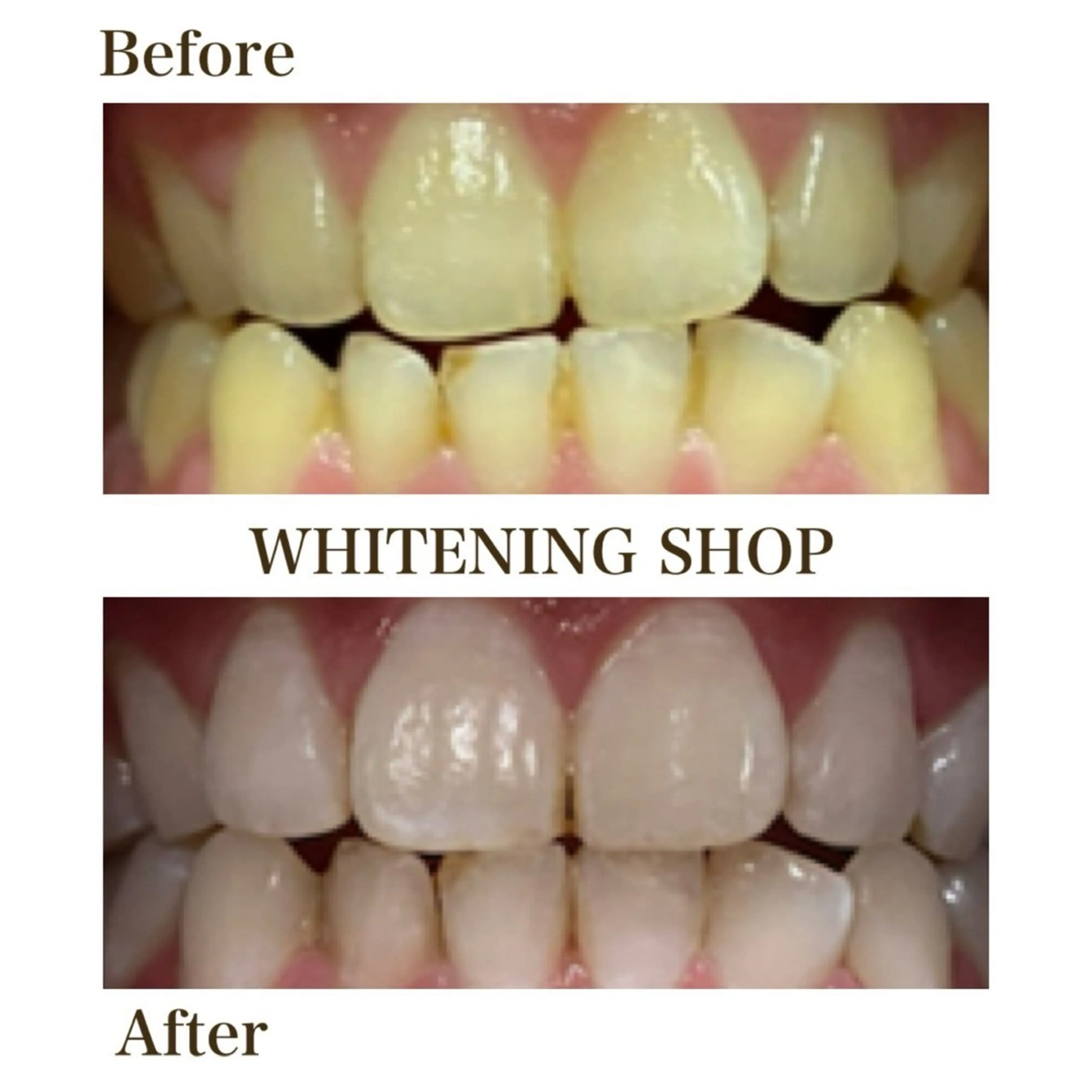 その他 ホワイトニングショップ静岡葵区店所属・ホワイトニング ショップ葵区静岡駅店のその他イメージ