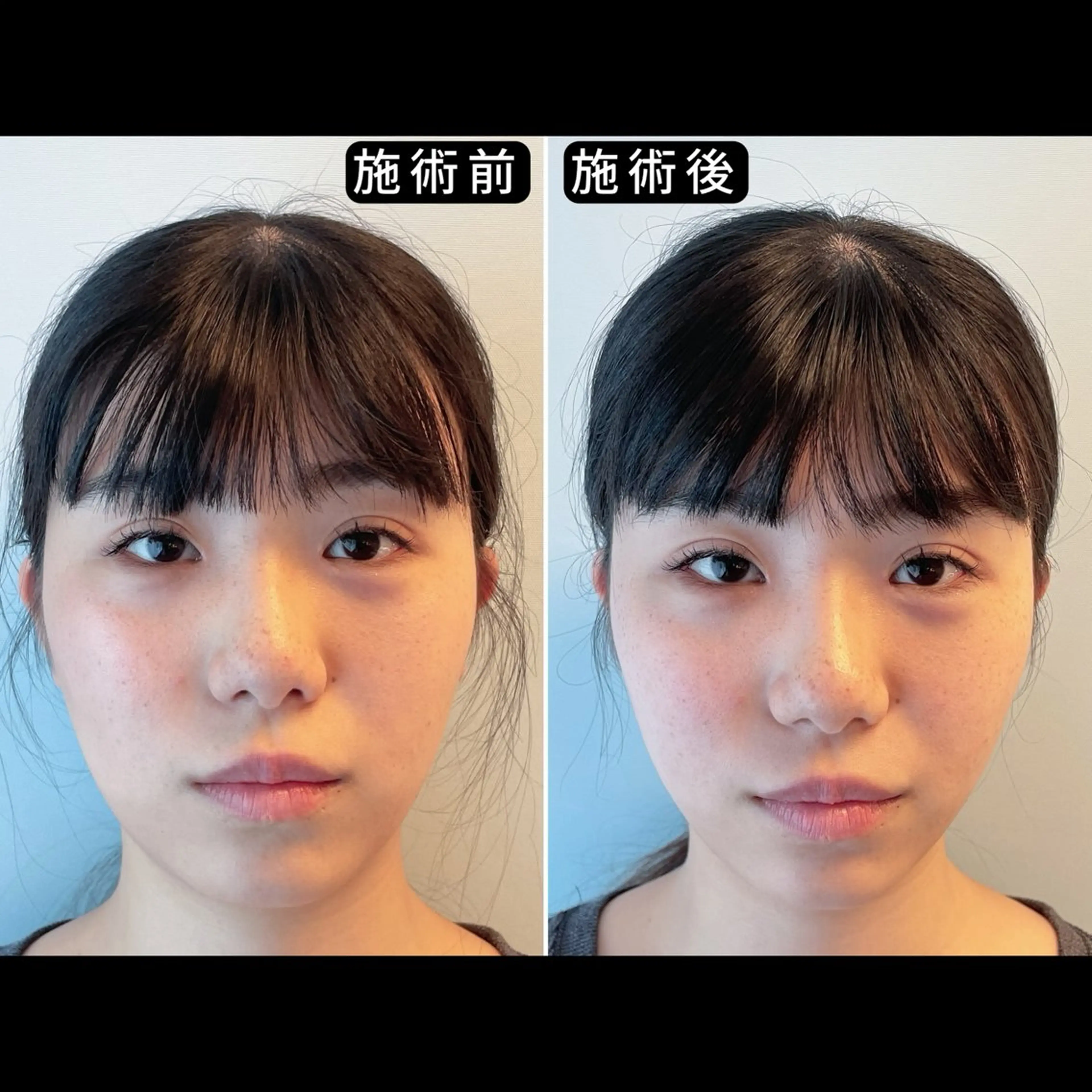 エステ リラク 渋谷 小顔美容鍼 専門サロン YZのエステ・リラクイメージ