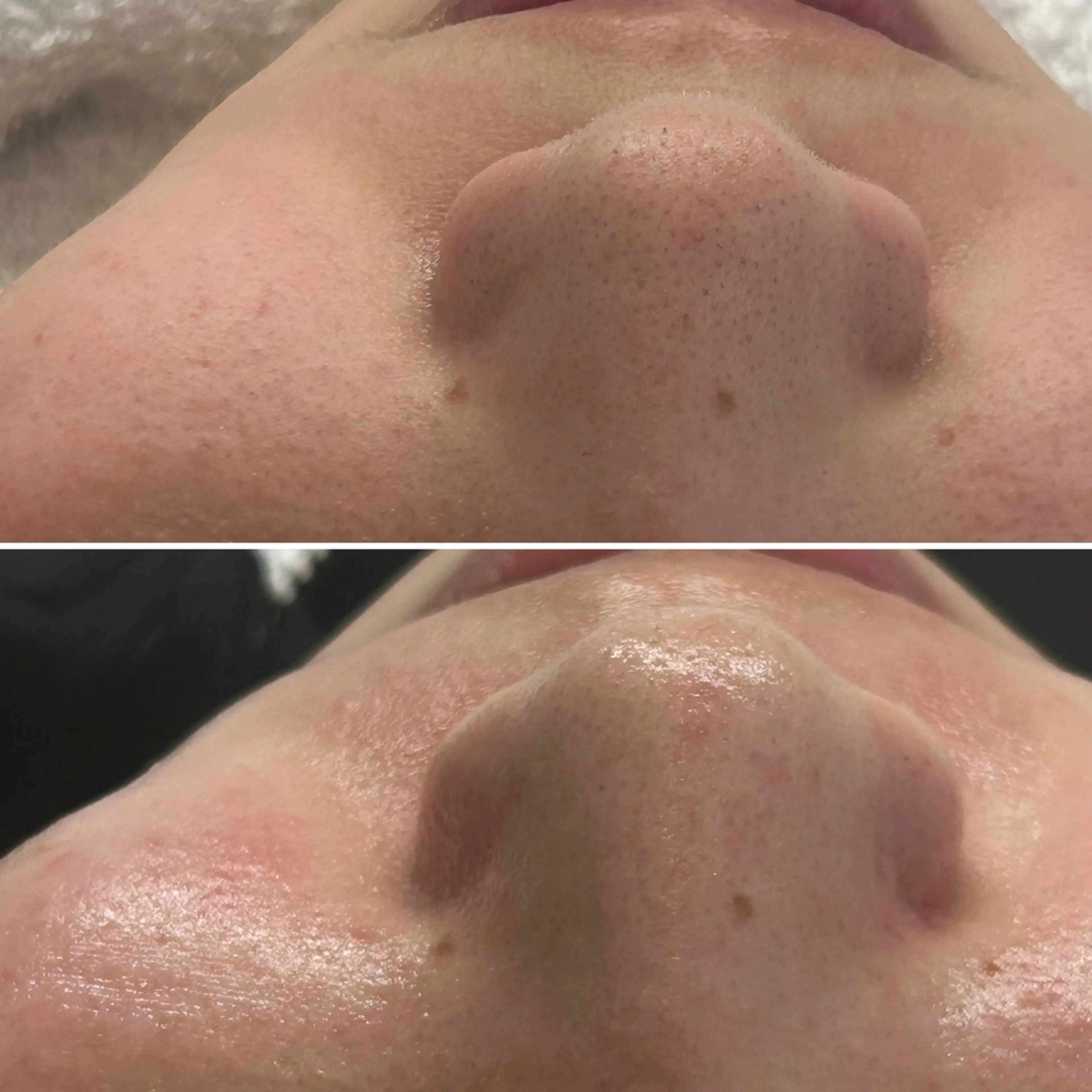 韓国🇰🇷価格 サロン_Nbibiのエステ・リラクイメージ