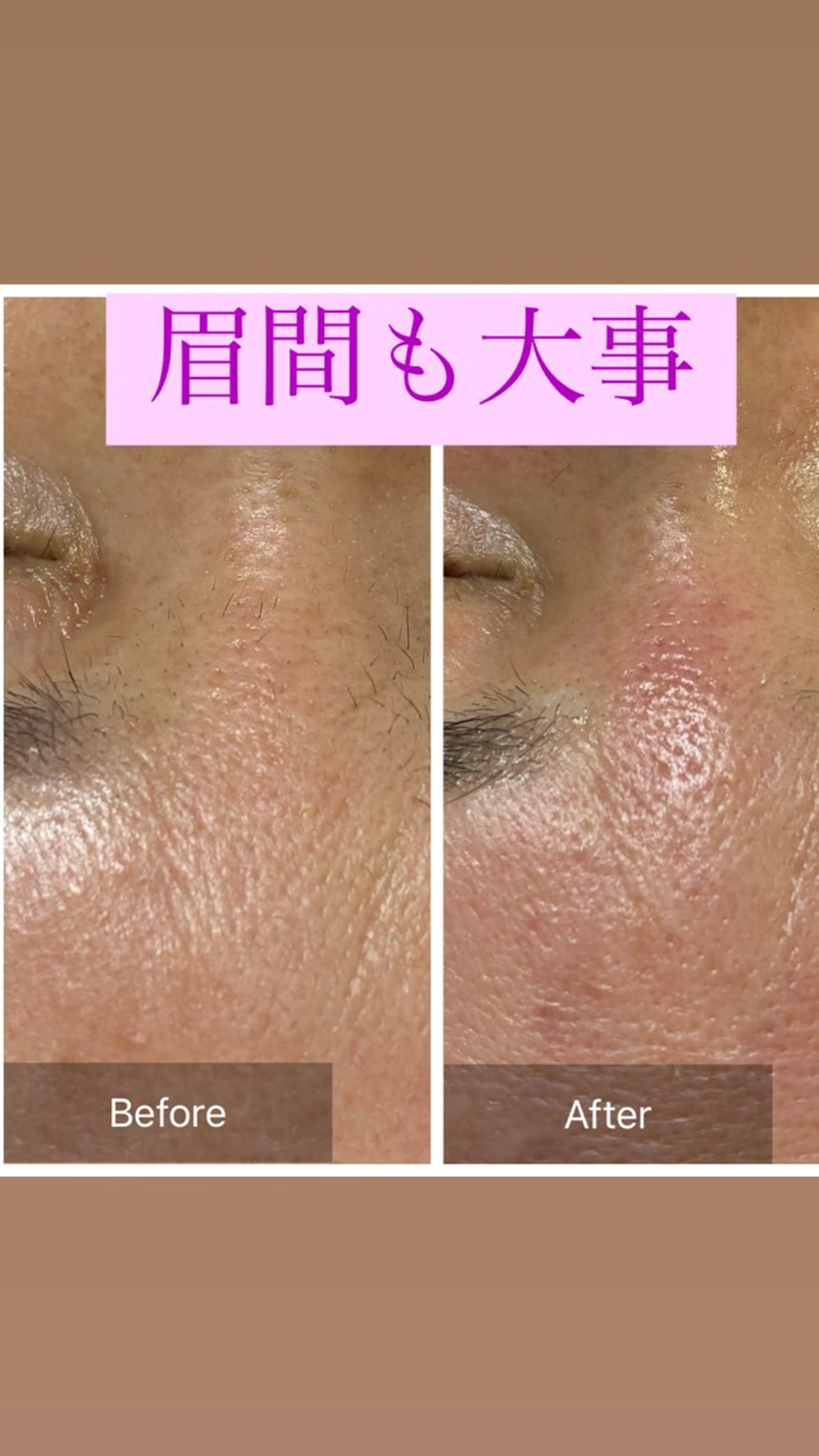 脱毛 産毛専門店 Bittoのエステ・リラクイメージ