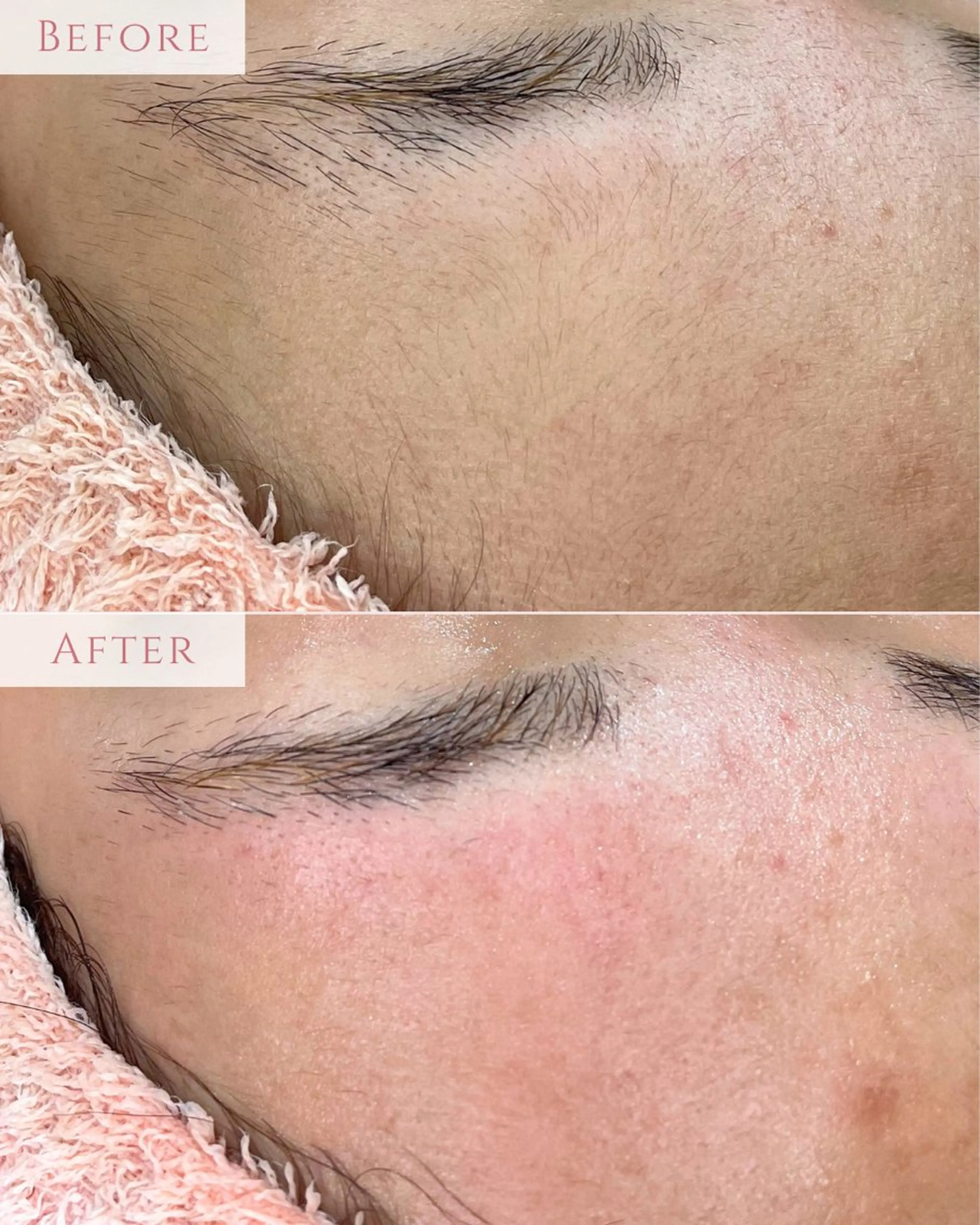 脱毛 肌質改善専門サロン Bellmi/心斎橋のエステ・リラクイメージ