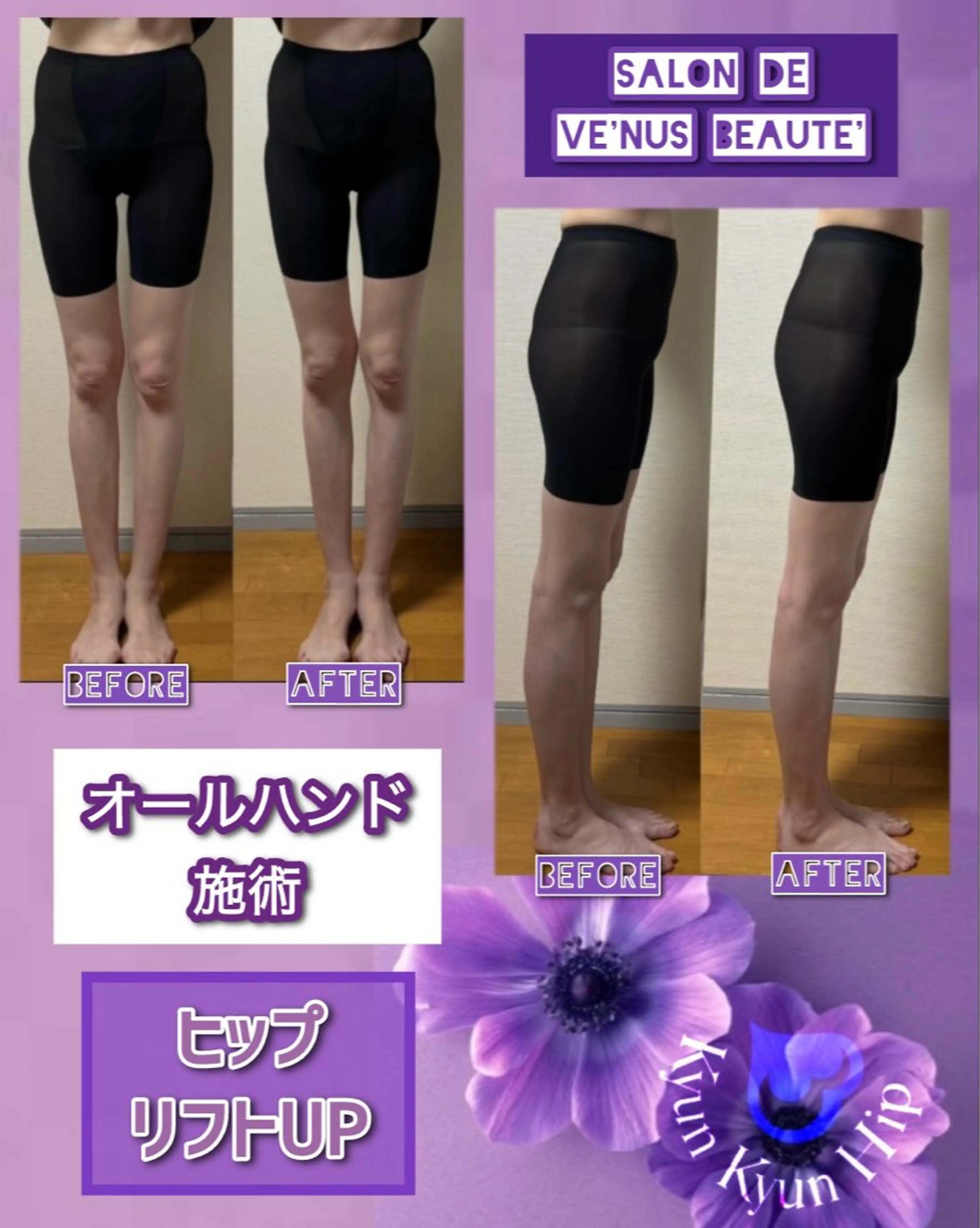 ヴィーナス ビューティーのエステ・リラクイメージ