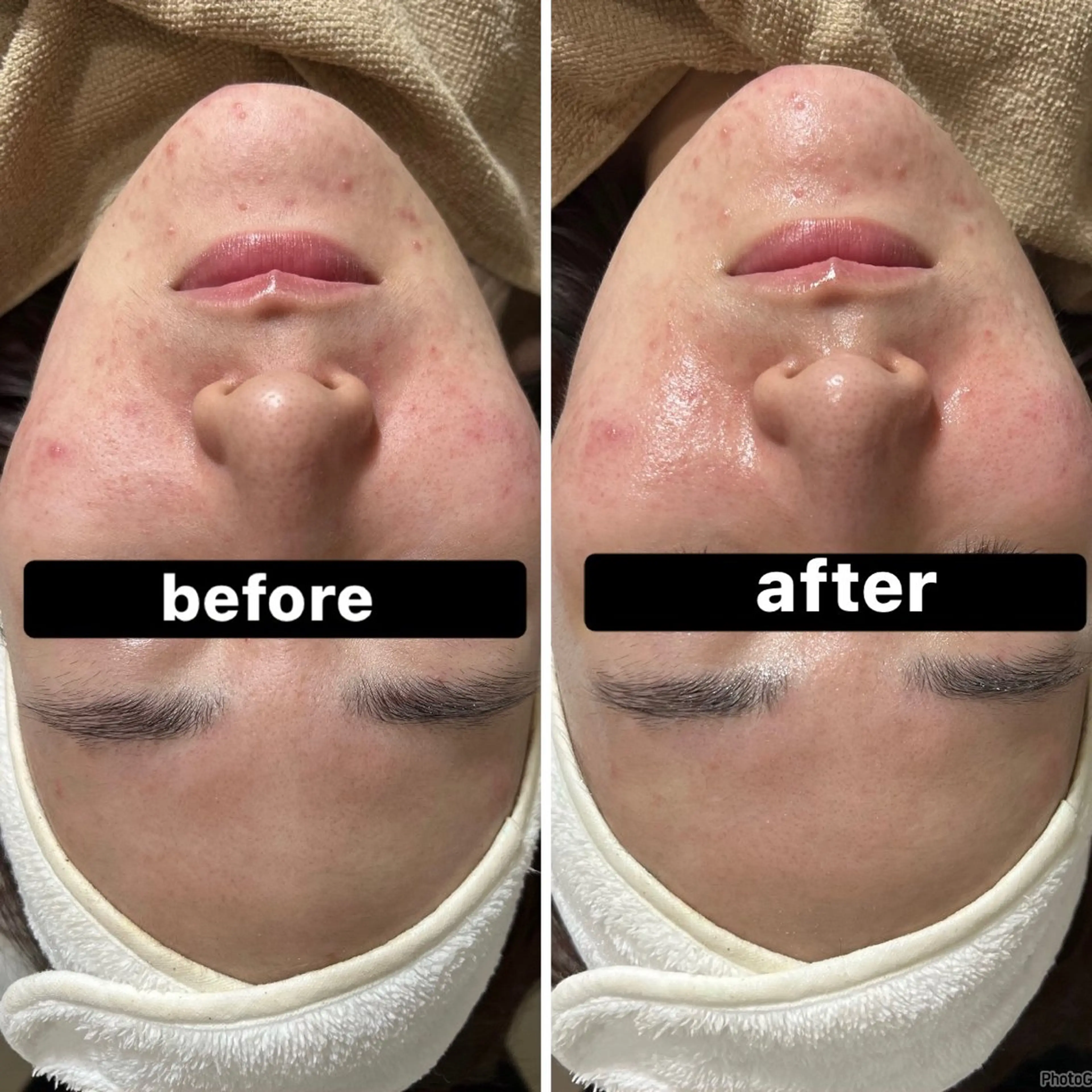 エステ 脱毛＆Beauty salon IILA所属・垢抜けお手伝い💖 Sakuraの眉毛・アイブロウイメージ