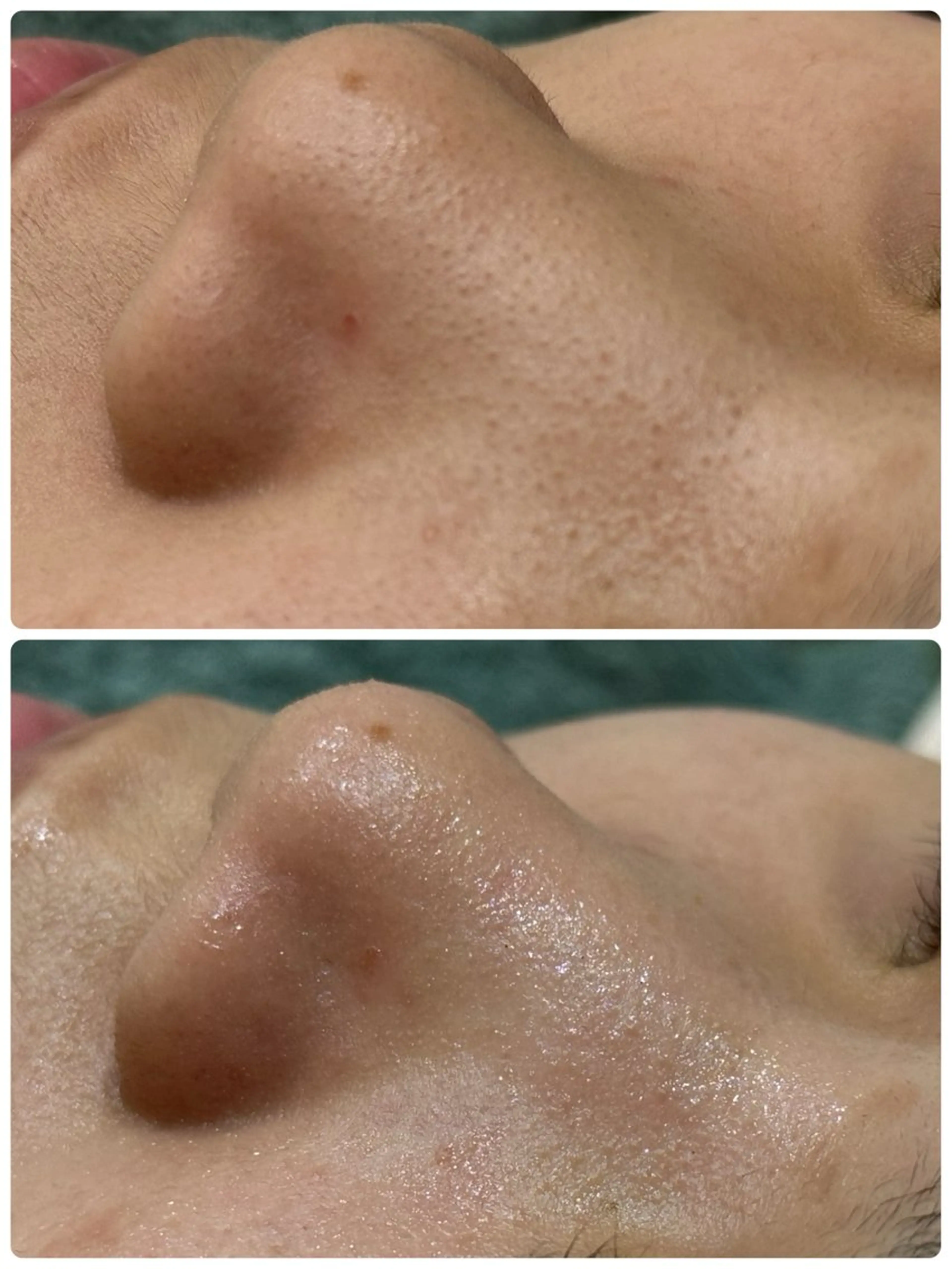 脱毛&フェイシャル 専門店muro.のエステ・リラクイメージ