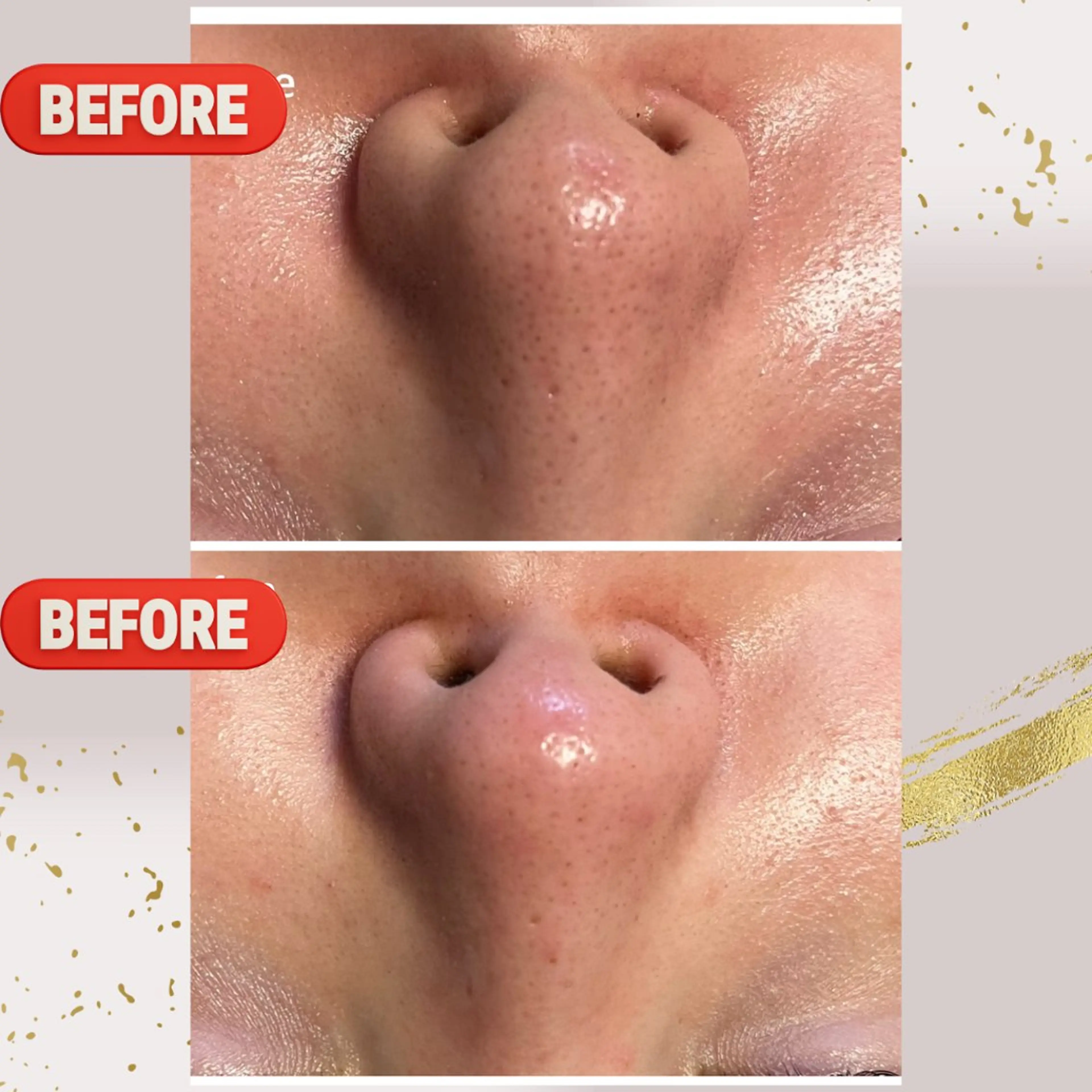 エステ リラク ピーリング専門店 Belluteのエステ・リラクイメージ