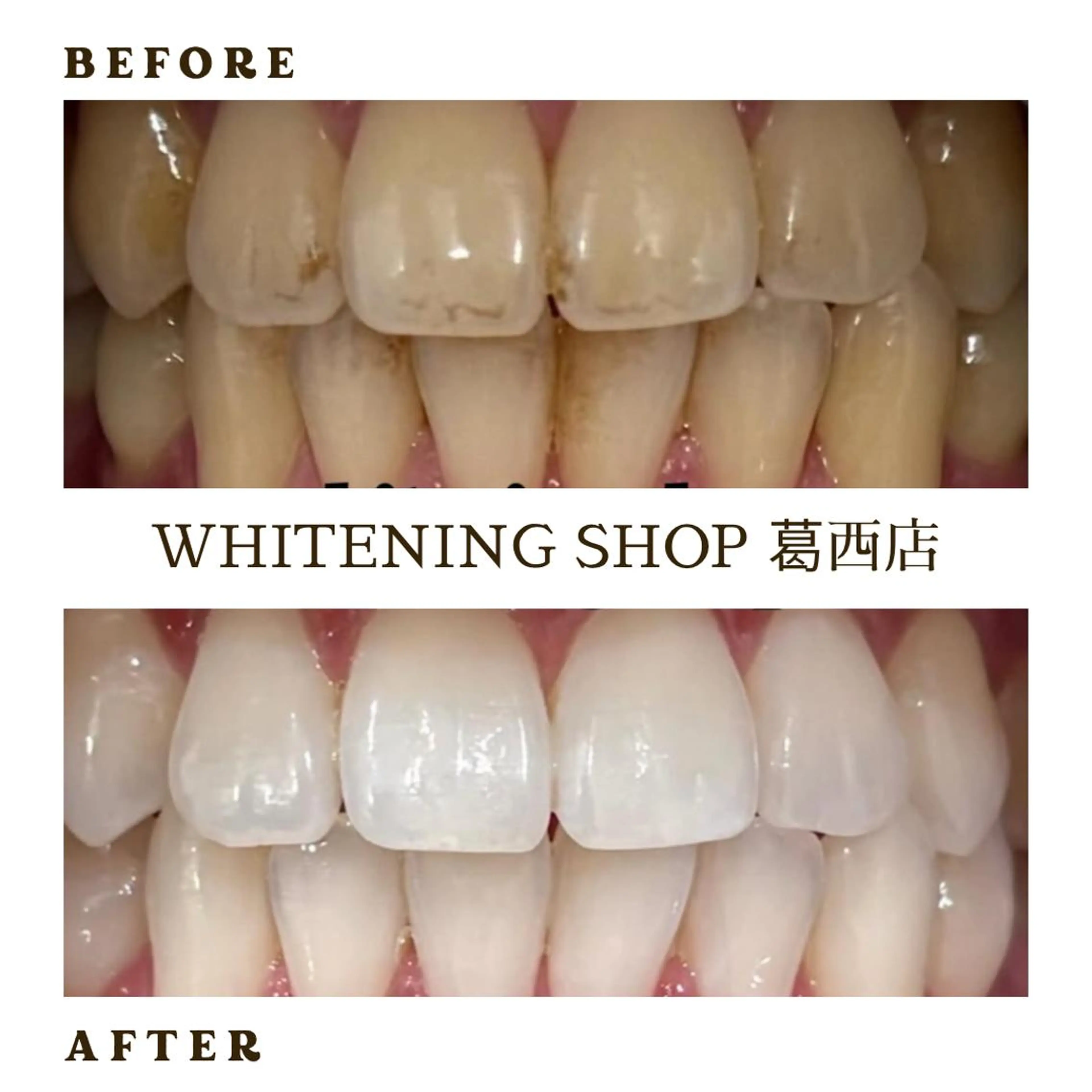 メンズ ホワイトニング ショップ葛西店のその他イメージ