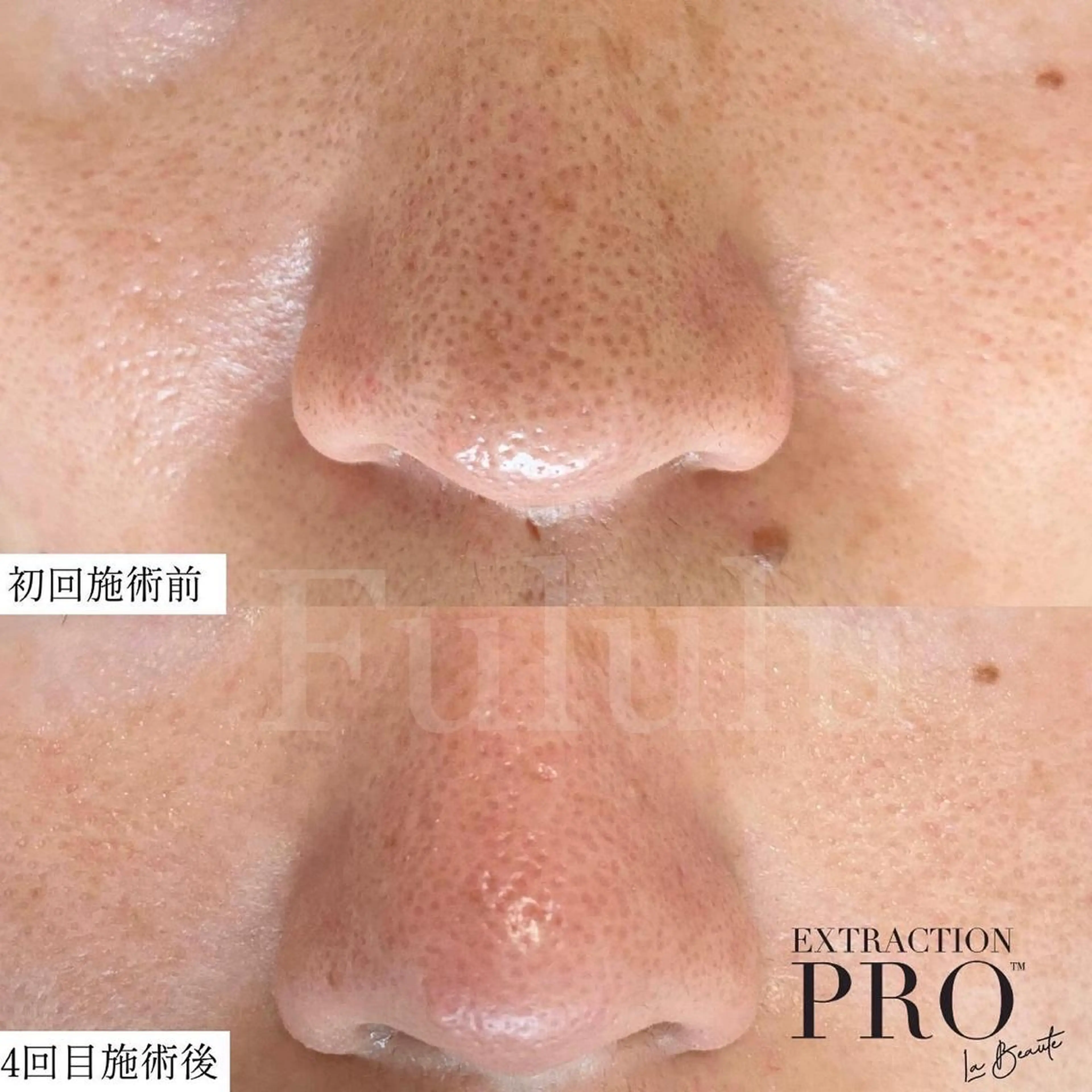 毛穴専門サロン　フルール所属・フルールFululu 自由が丘のエステ・リラクイメージ