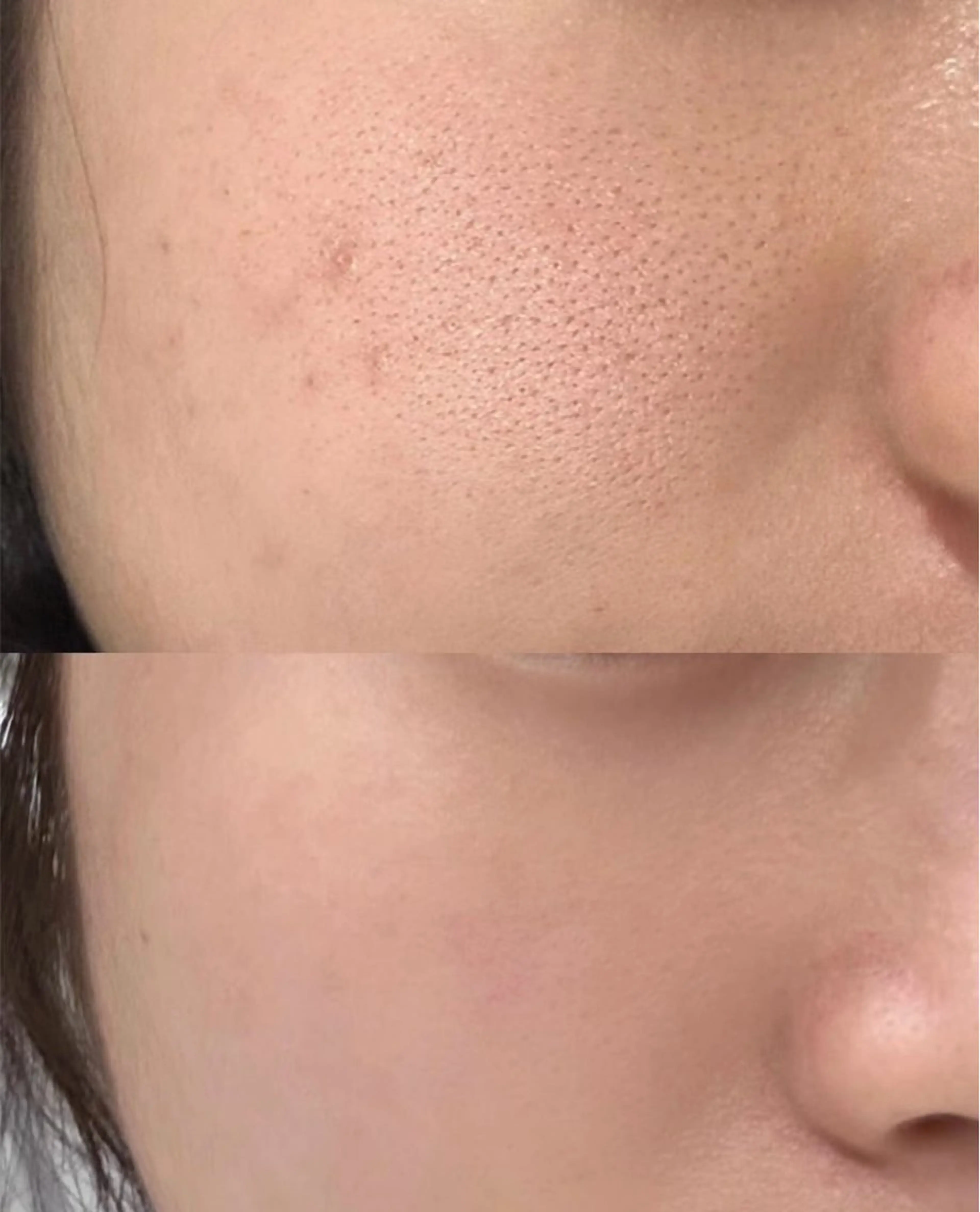 カラー エステ 愛維美水光美肌専門店所属・愛維美水光美肌専門店 メンズレディースokのエステ・リラクイメージ